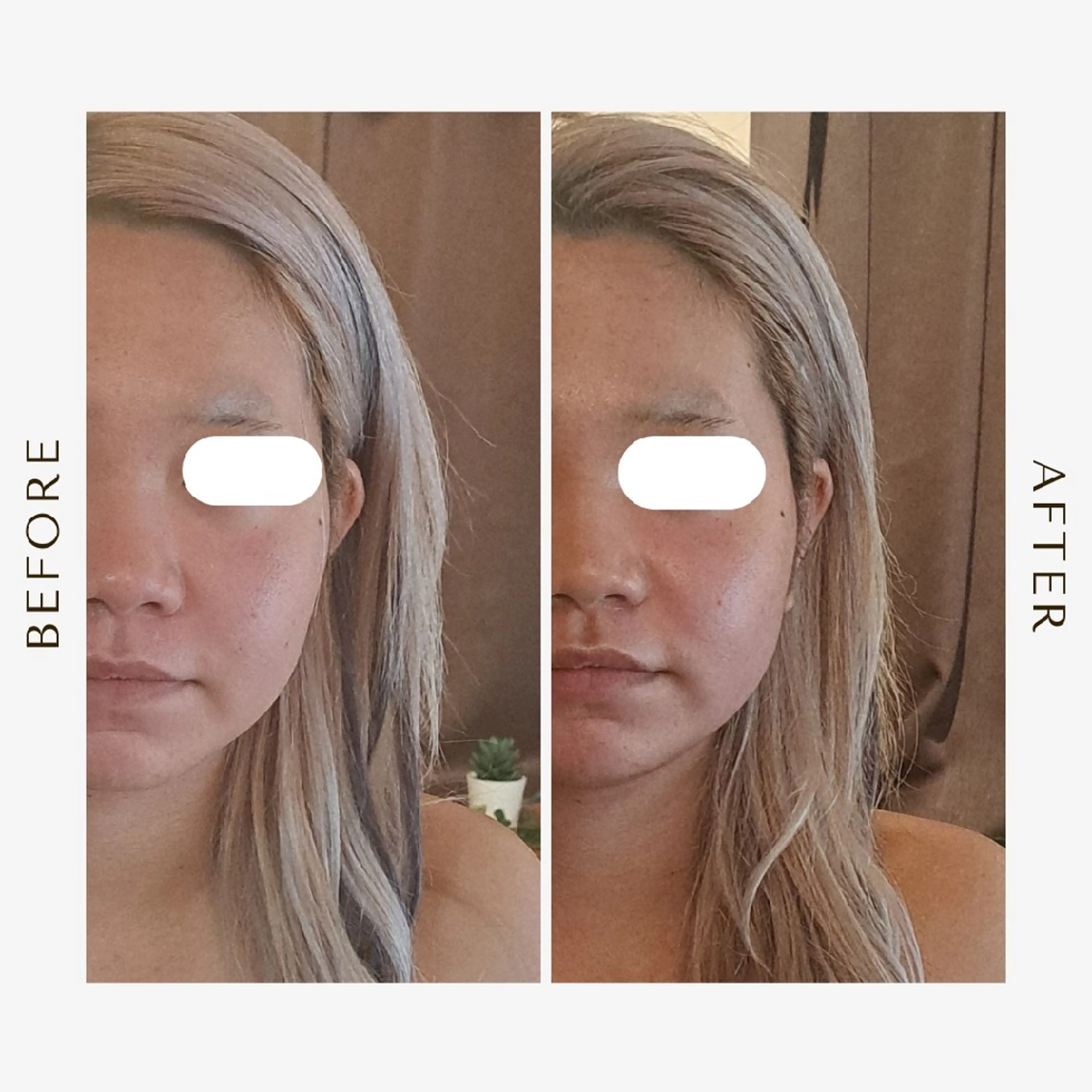 エステ リラク 美容鍼×エステ　鍼灸 サロンmiyabiのエステ・リラクイメージ