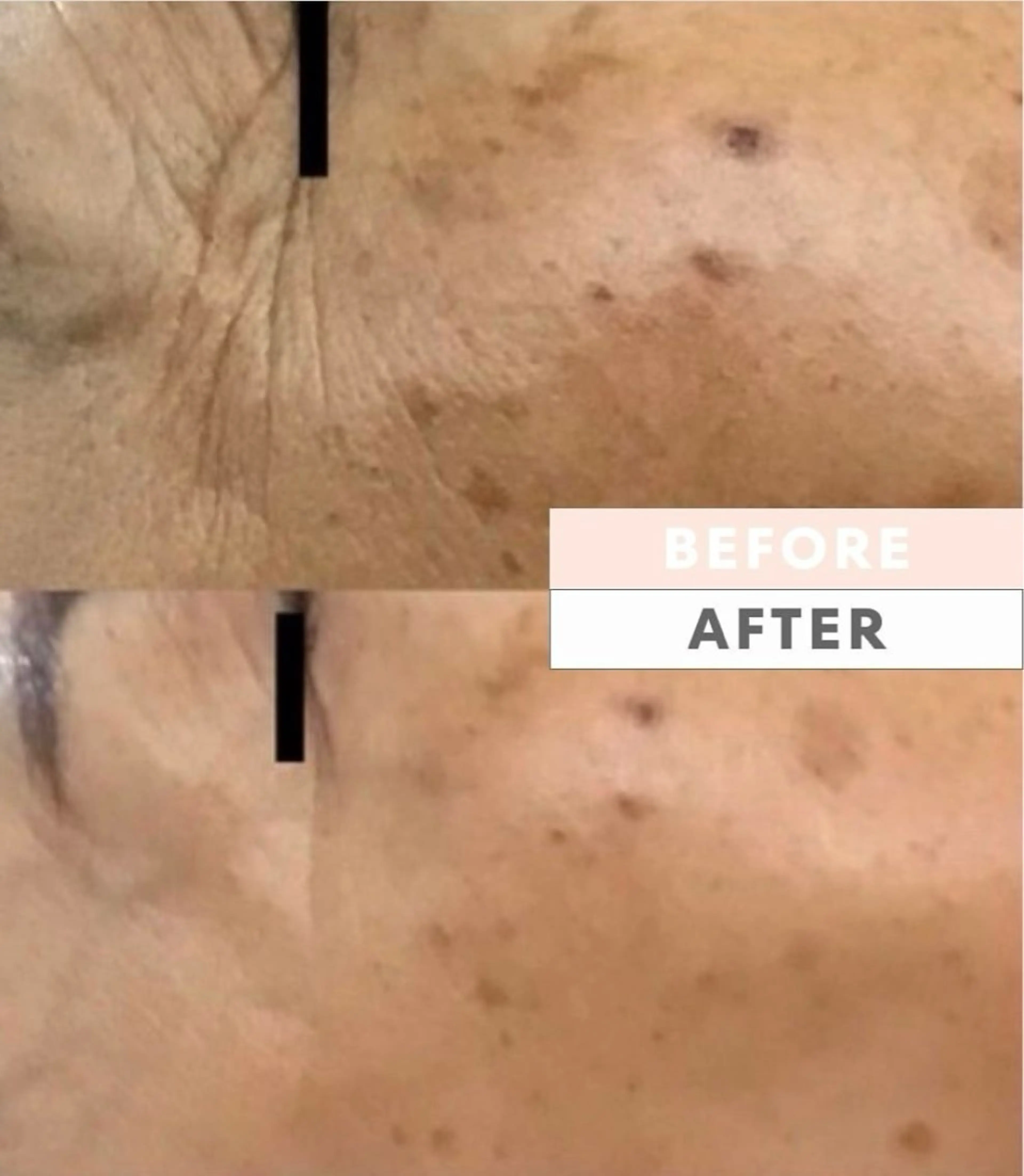 水光韓国肌ハーブ ピーリングMplusのエステ・リラクイメージ