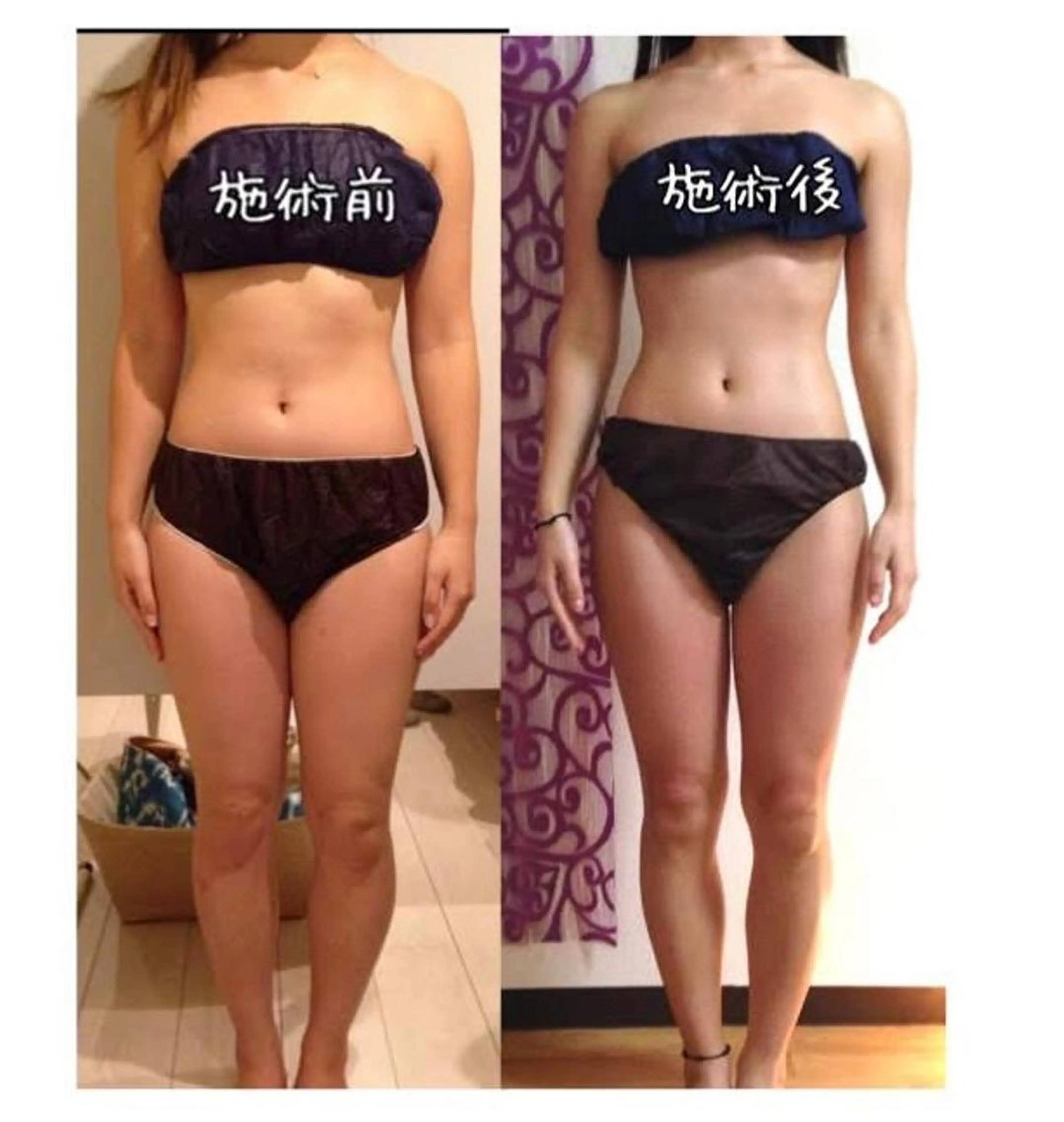 ショート カラー パーマ ヘアアレンジ メンズ キッズ ネイル マツエク・マツパ アイブロウ 結婚式・ブライダル 結婚式・ブライダル 小顔カット トリートメント ブライダルネイル 強圧オールハンド痩身 片野のエステ・リラクイメージ