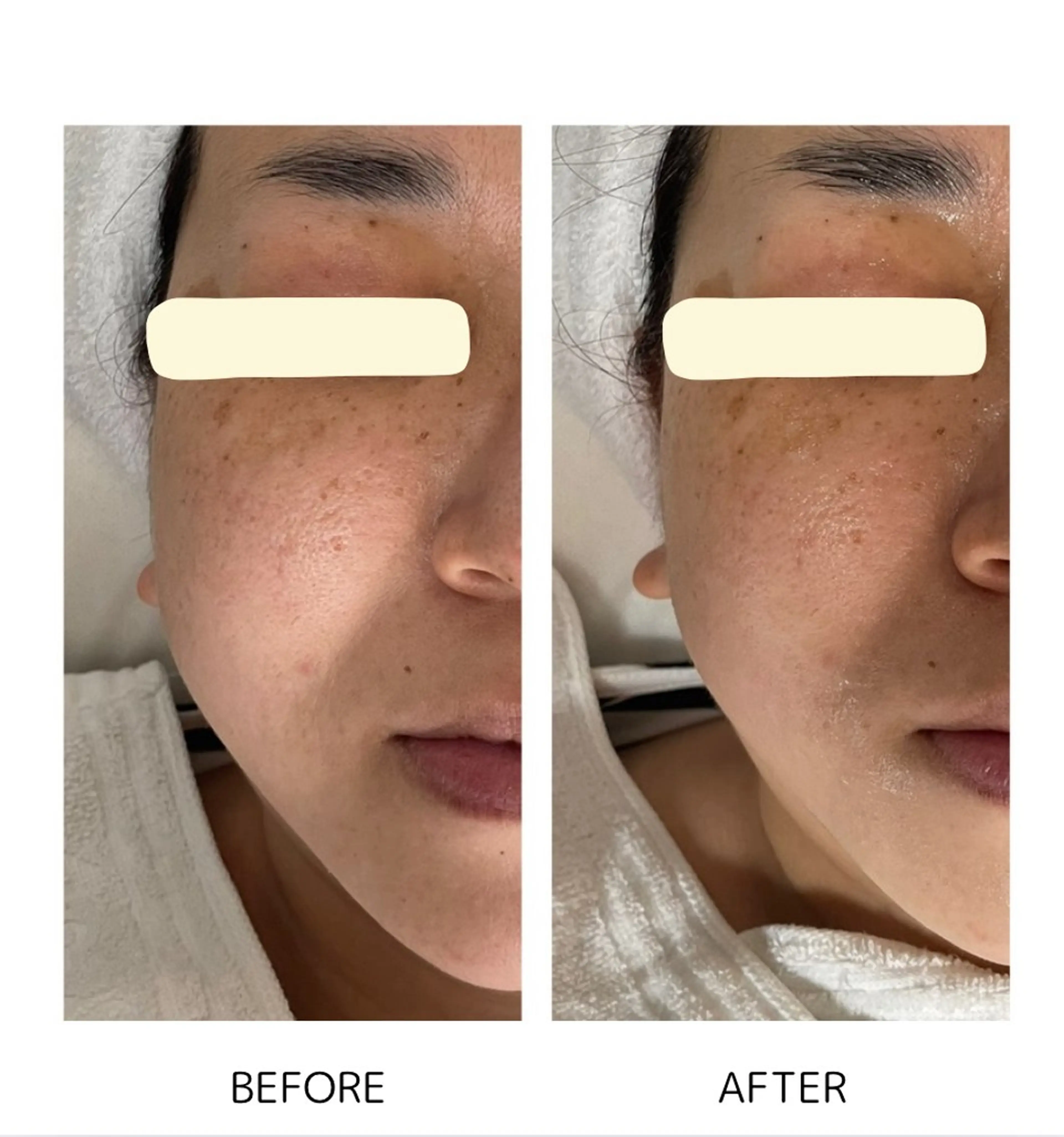 Yoshino Erinaのエステ・リラクイメージ