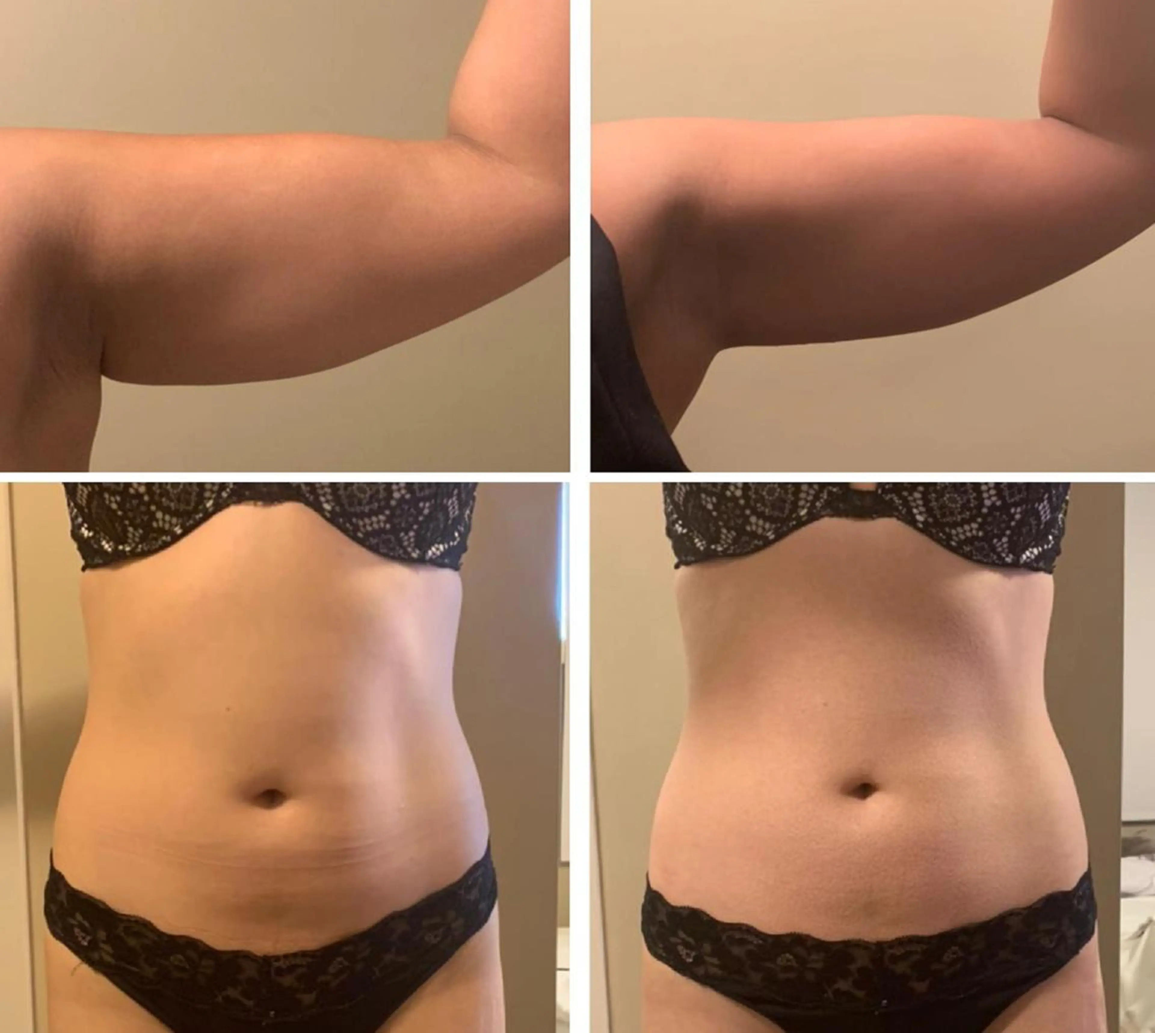 エステ 全身脱毛&VIO脱毛 紹介率№1♪リナ♪のエステ・リラクイメージ