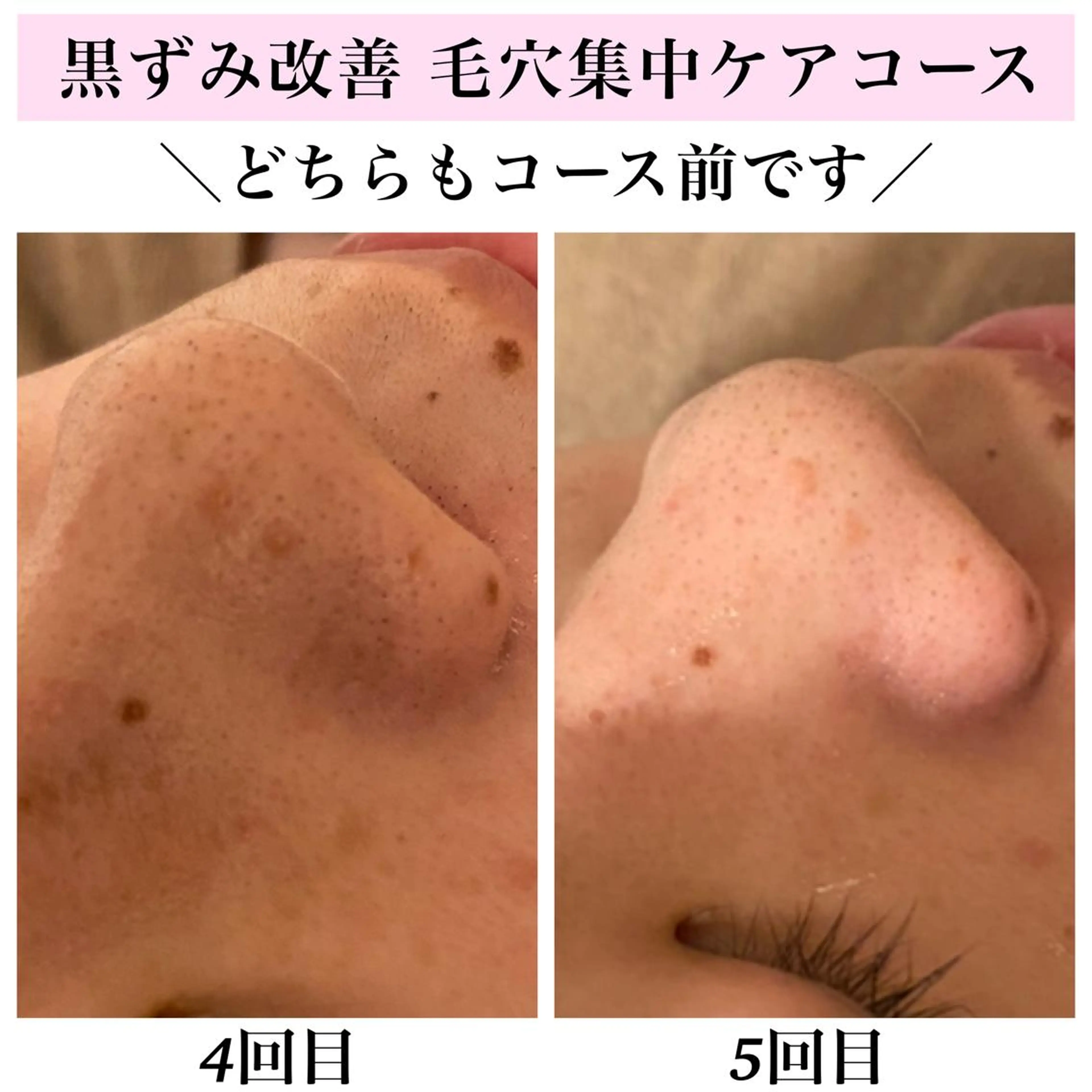 エステ リラク Bellesthe （ベルエステ）のエステ・リラクイメージ