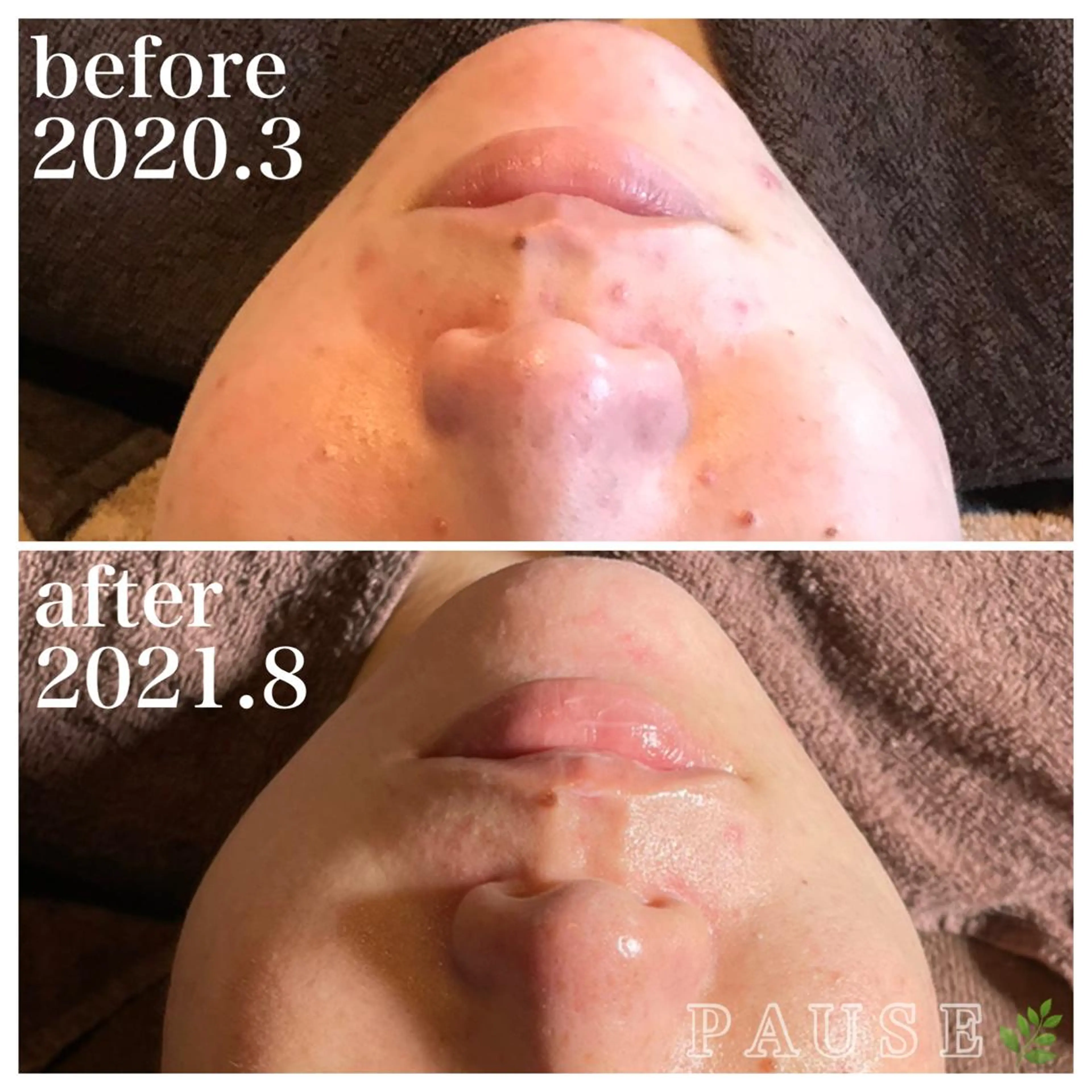 エステ 浜野 恵美のエステ・リラクイメージ