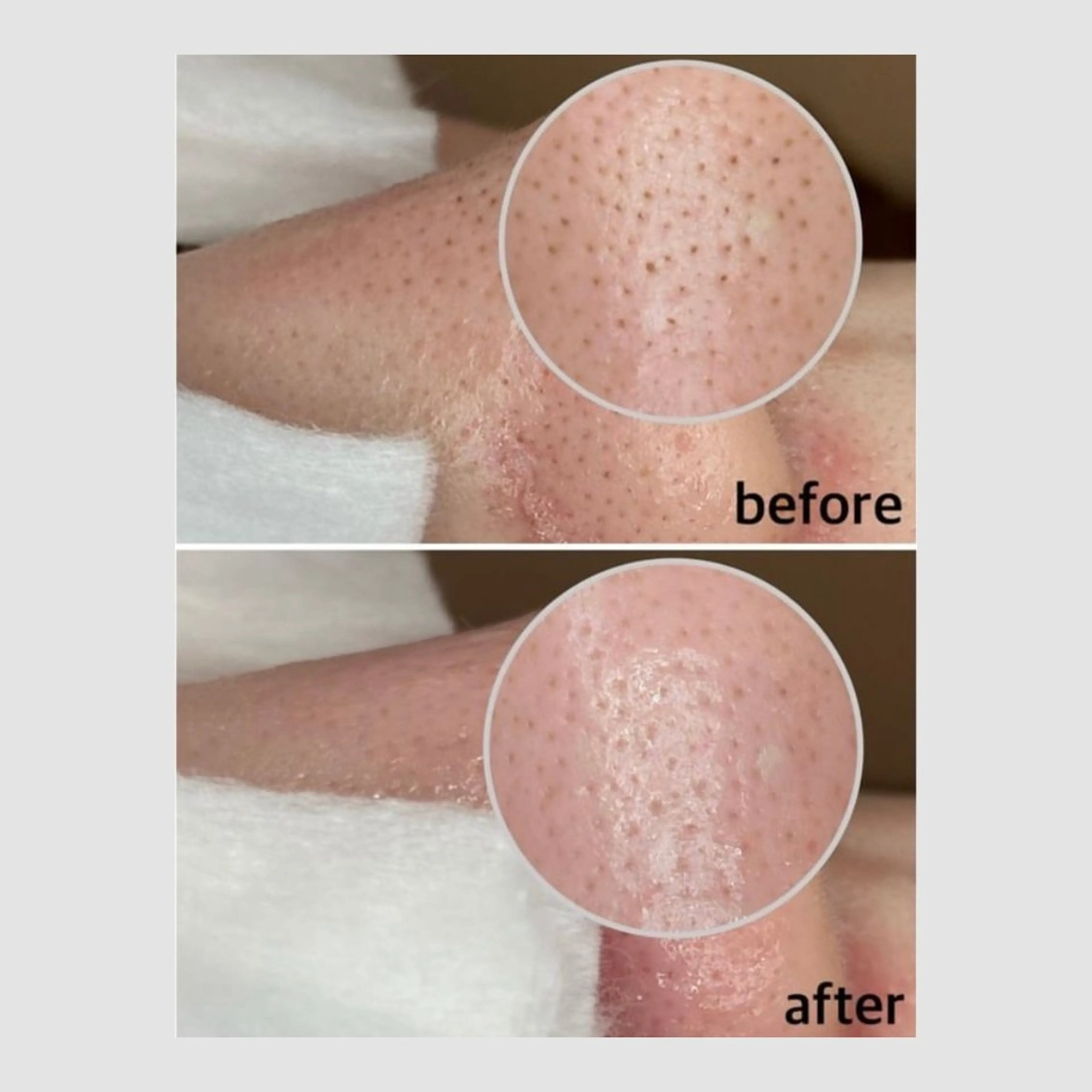 エステ リラク 韓国肌管理 【毛穴専科】のエステ・リラクイメージ