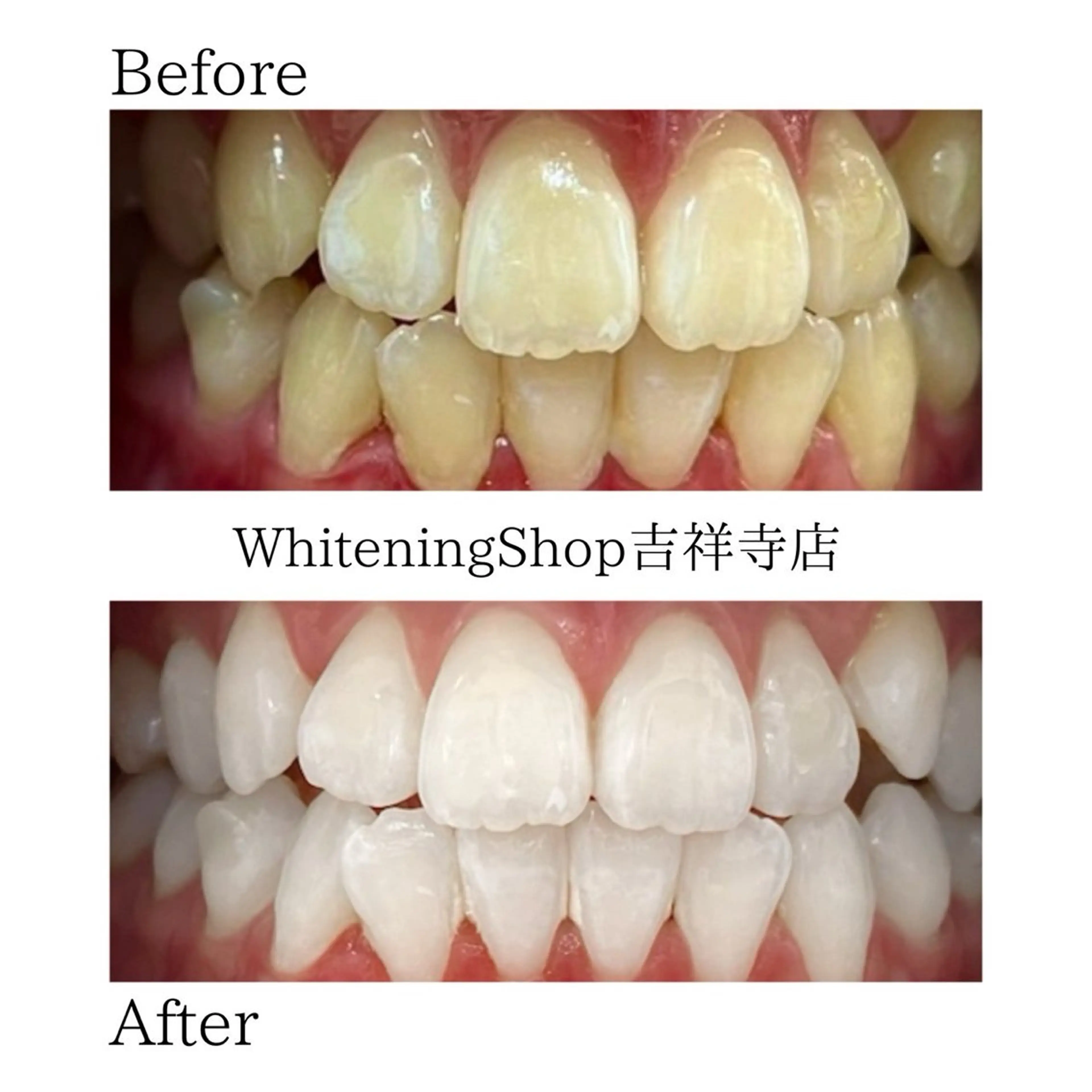 エステ リラク ホワイトニング ショップ吉祥寺店のエステ・リラクイメージ