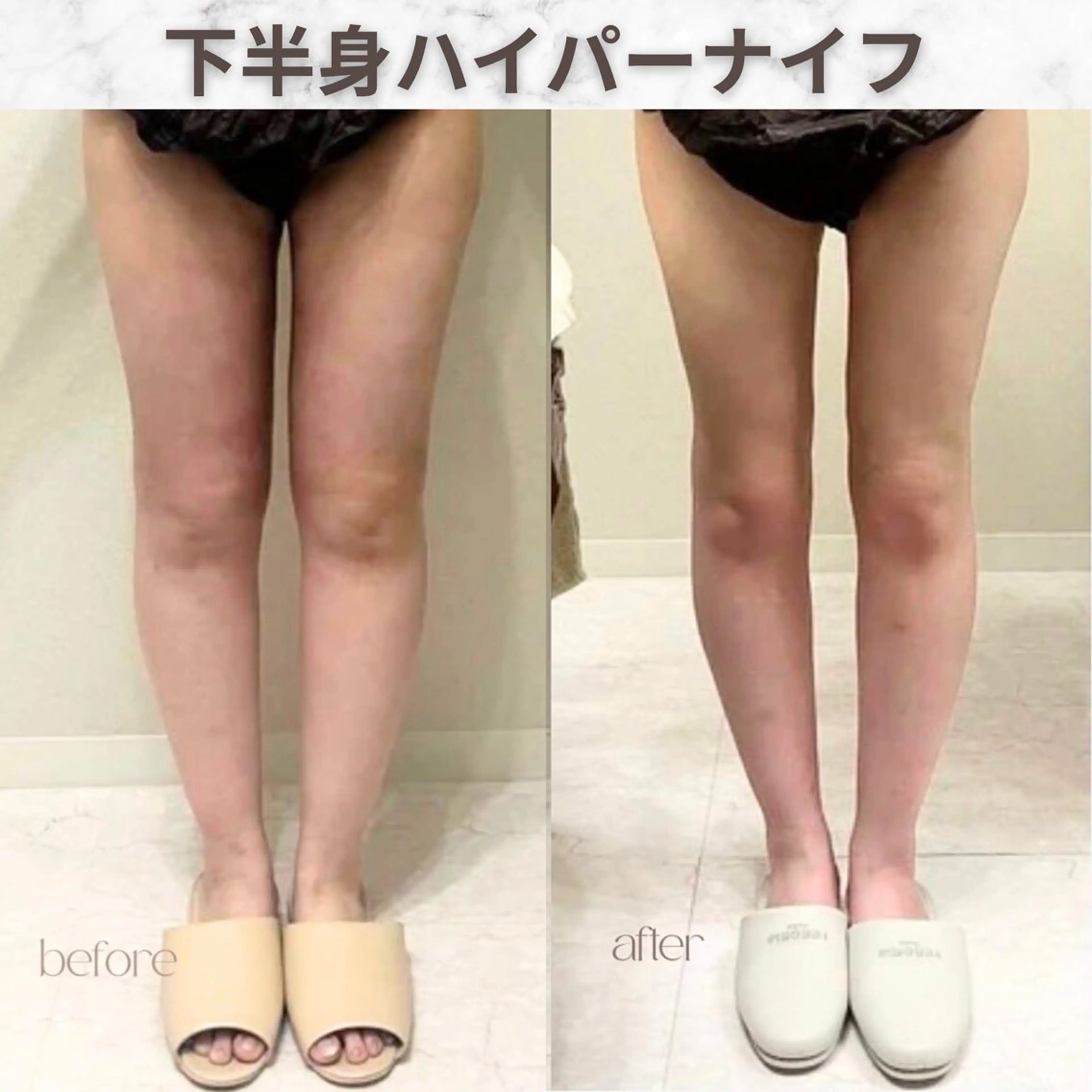 aimer服部 /  小顔 ・ 痩身のその他イメージ