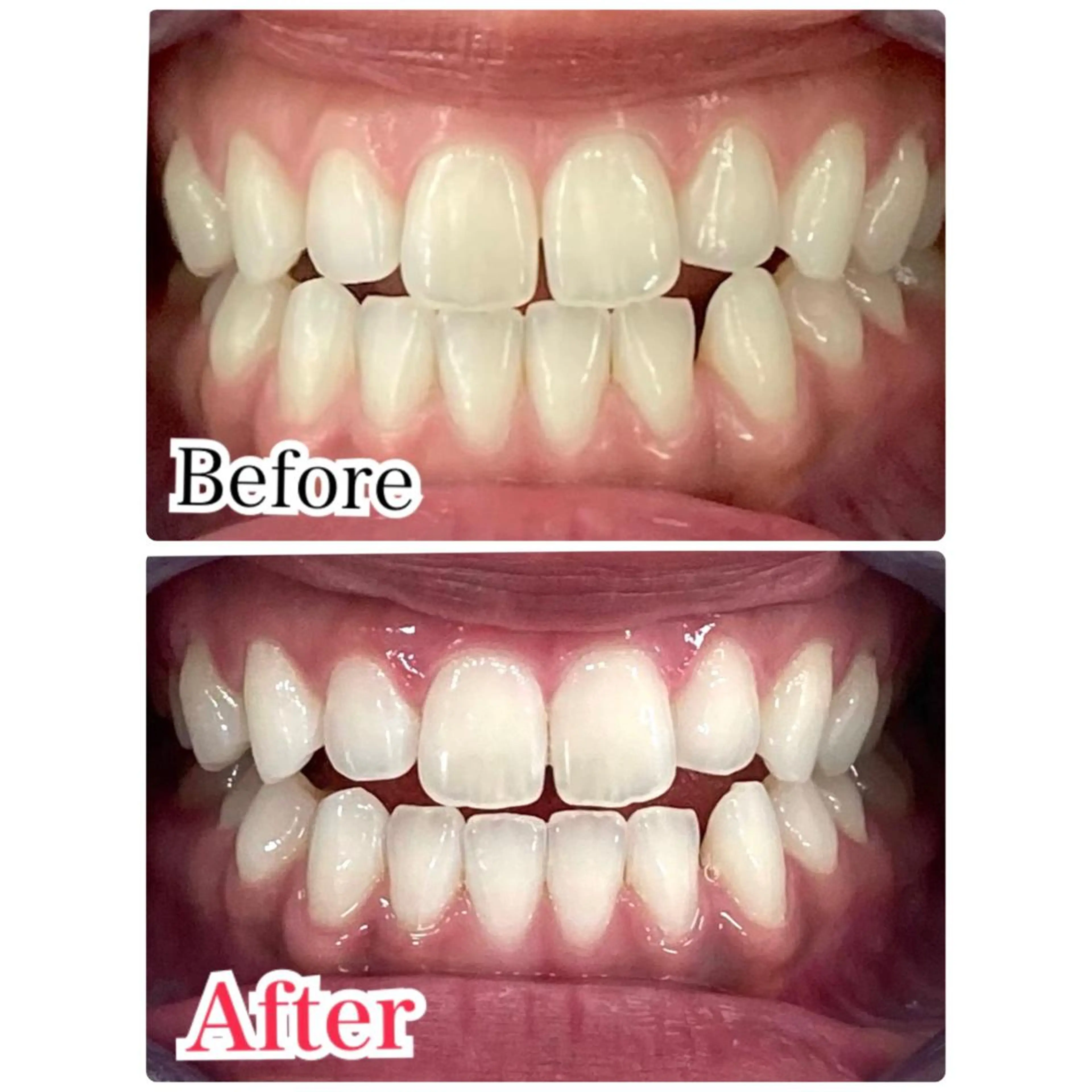 ロング ネイル マツエク・マツパ ホワイト プラチナムビューティー柏所属・【歯科提携】柏ホワイ トニングスタイルのその他イメージ