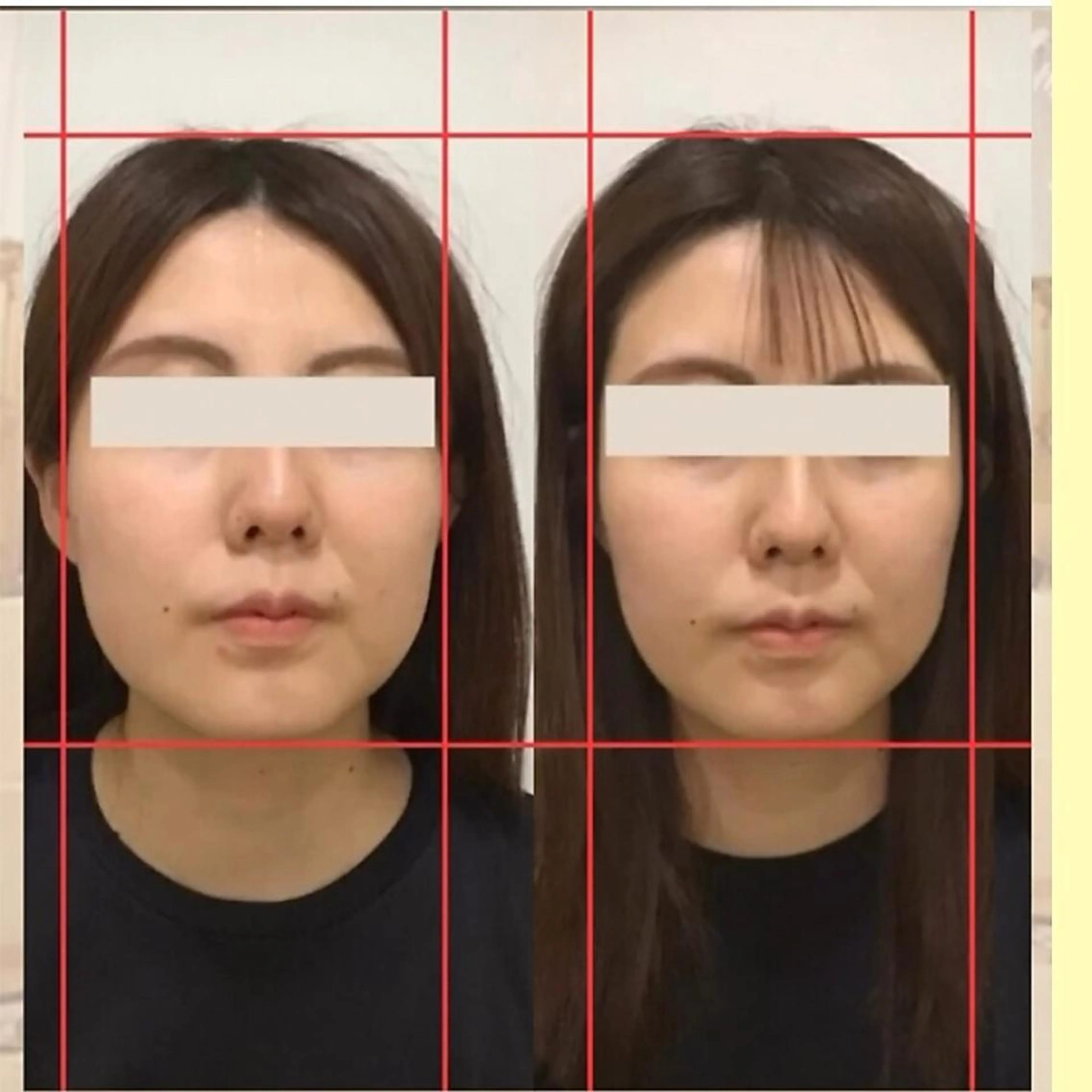 【整った輪郭へ】小顔3D整顔＆肩こり・首こりケア カウンセリング含む全体50分の写真