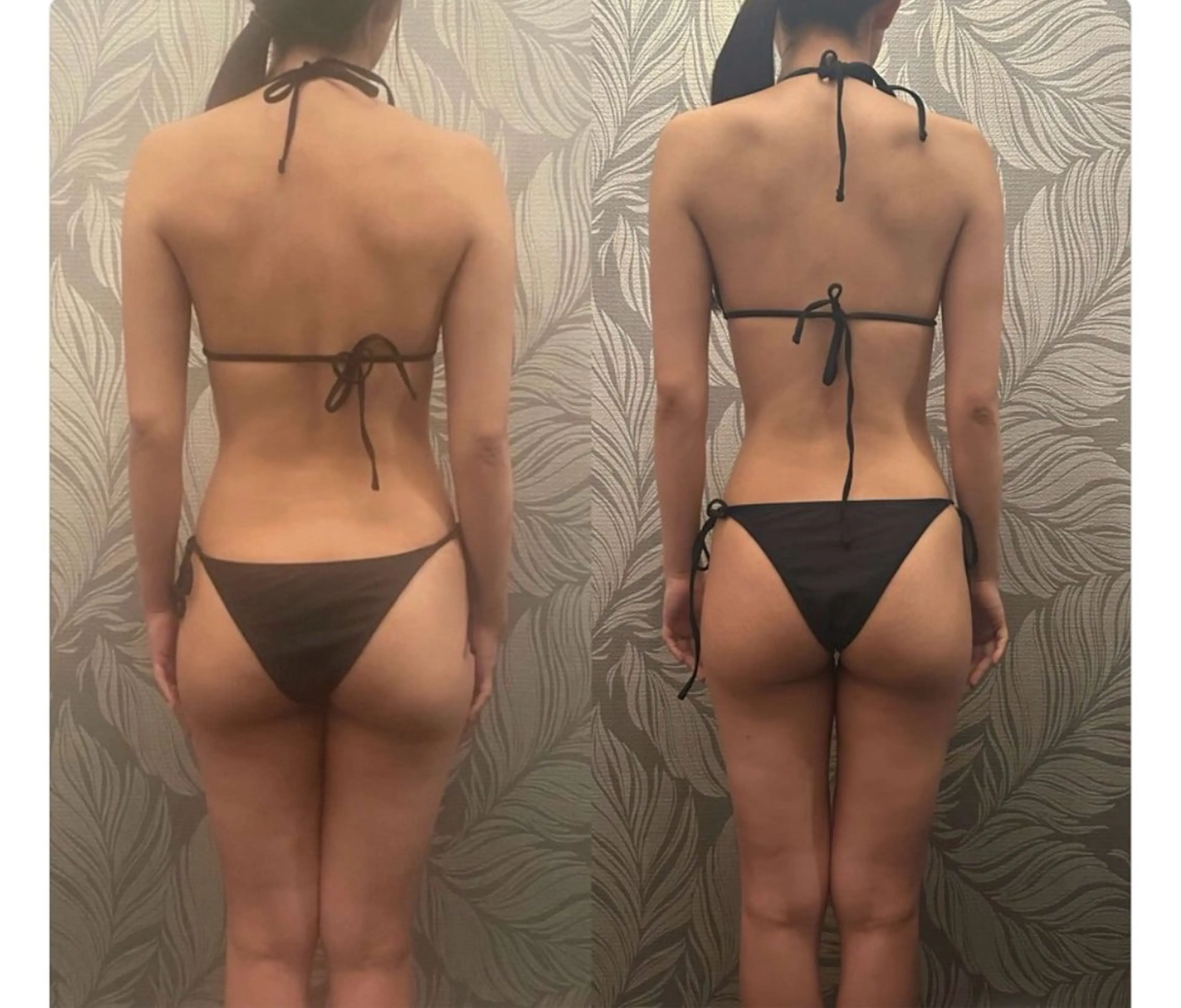 【選考制／2ヶ月集中】本気で変わりたい方向け🔥オールハンドダイエットモニター（ミニモ限定）の写真