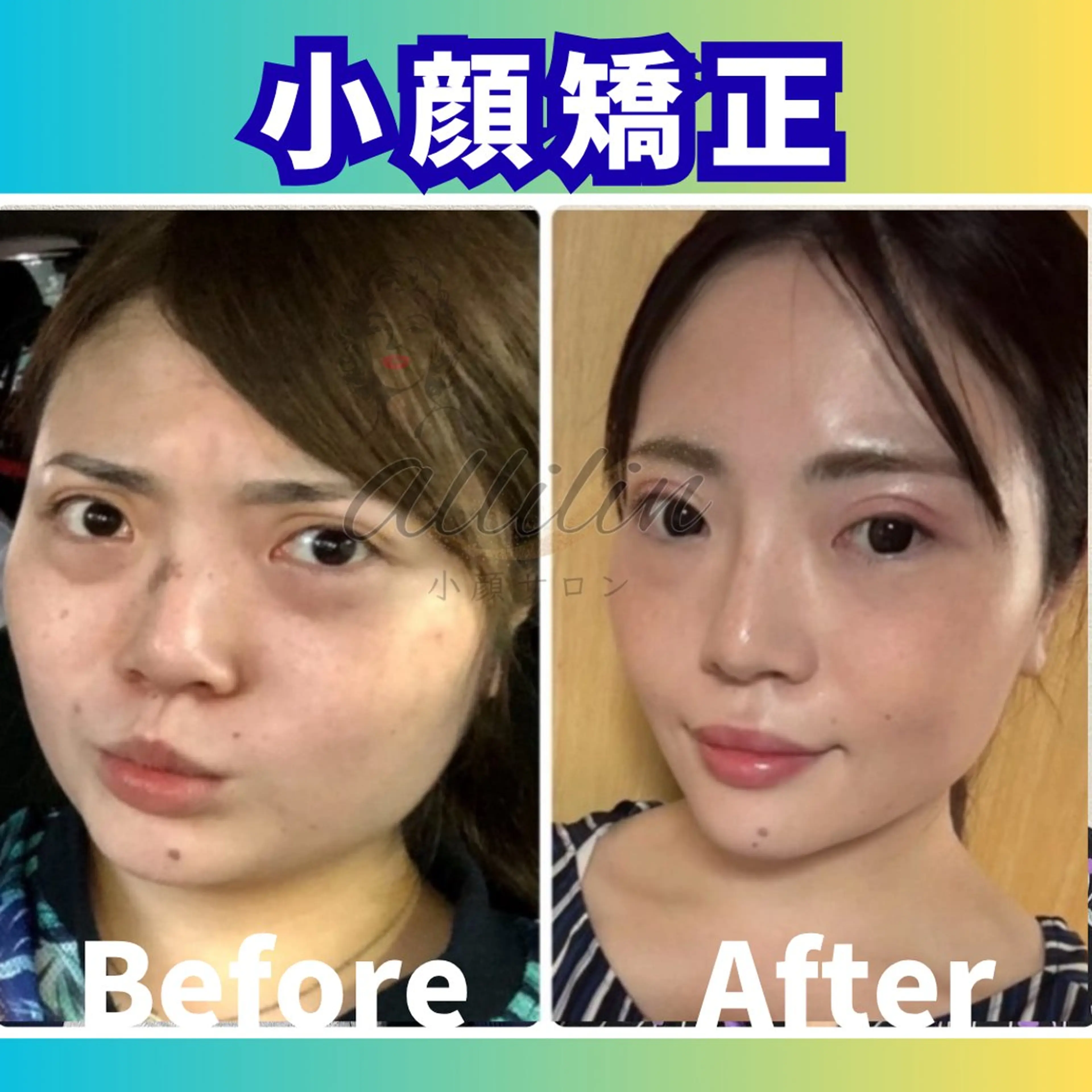 💎小顔ｻﾛﾝ アリリン銀座💎のエステ・リラクイメージ