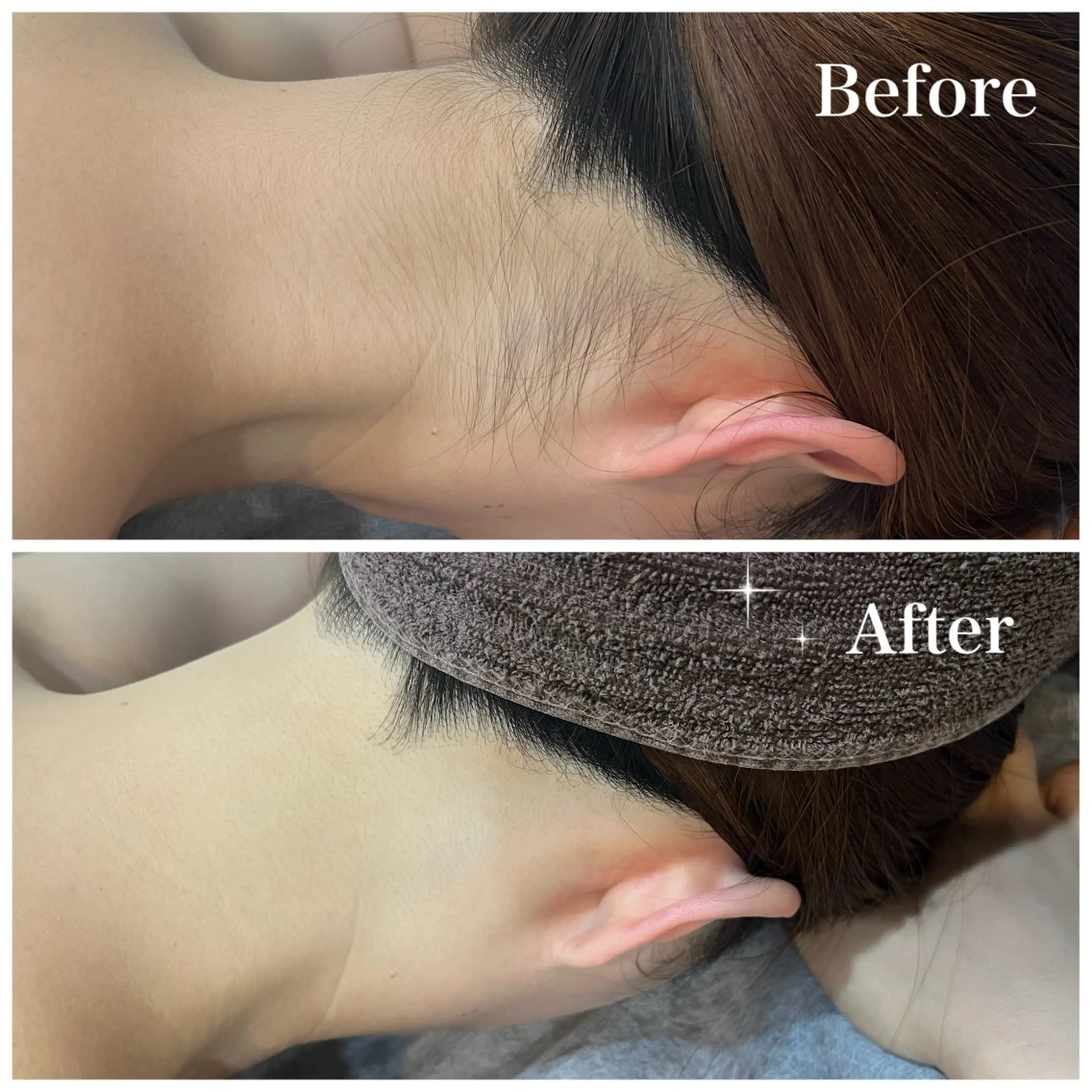 脱毛 脱毛サロン fam.豊澤柚良のエステ・リラクイメージ