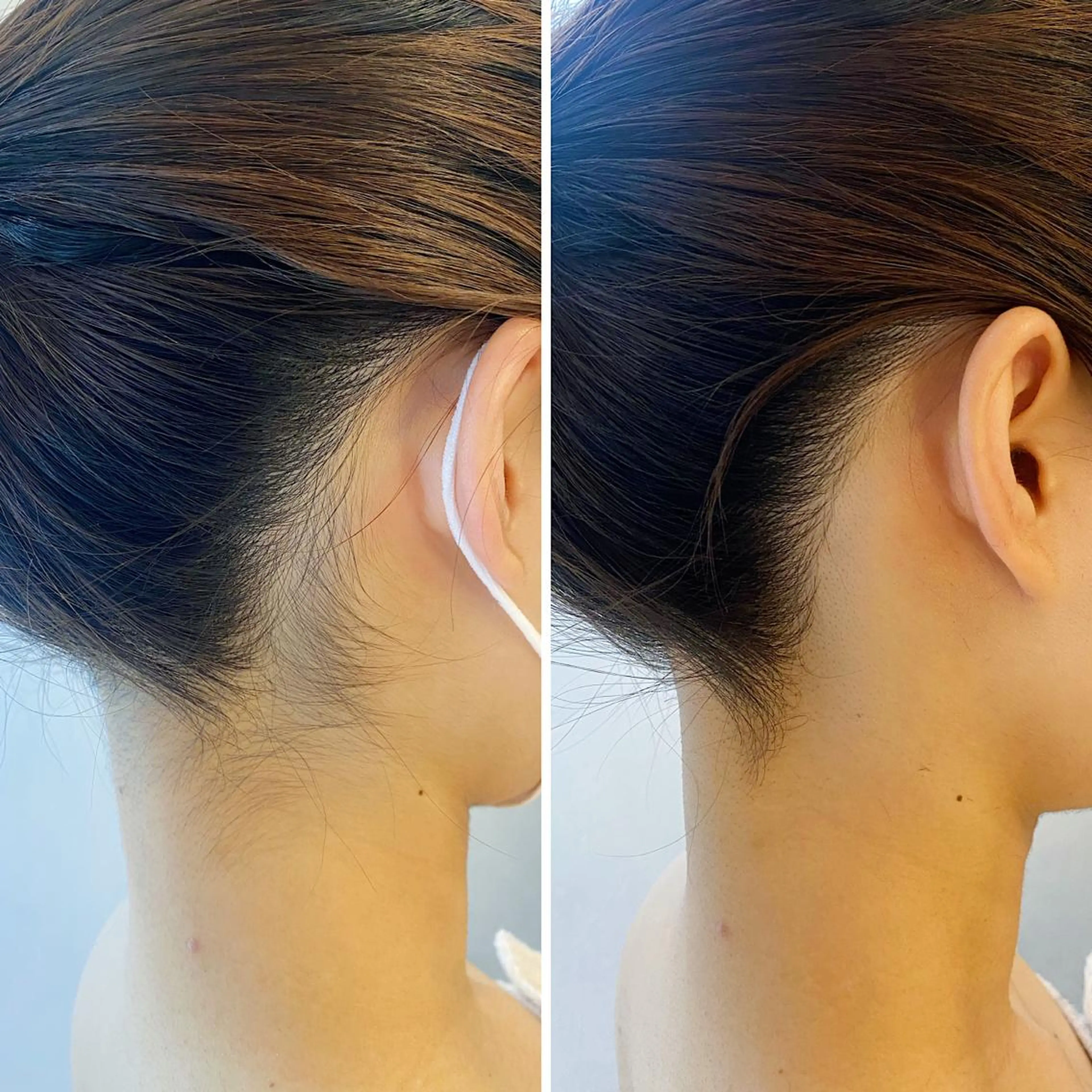 脱毛 うなじ脱毛/美肌脱毛 LABELのエステ・リラクイメージ