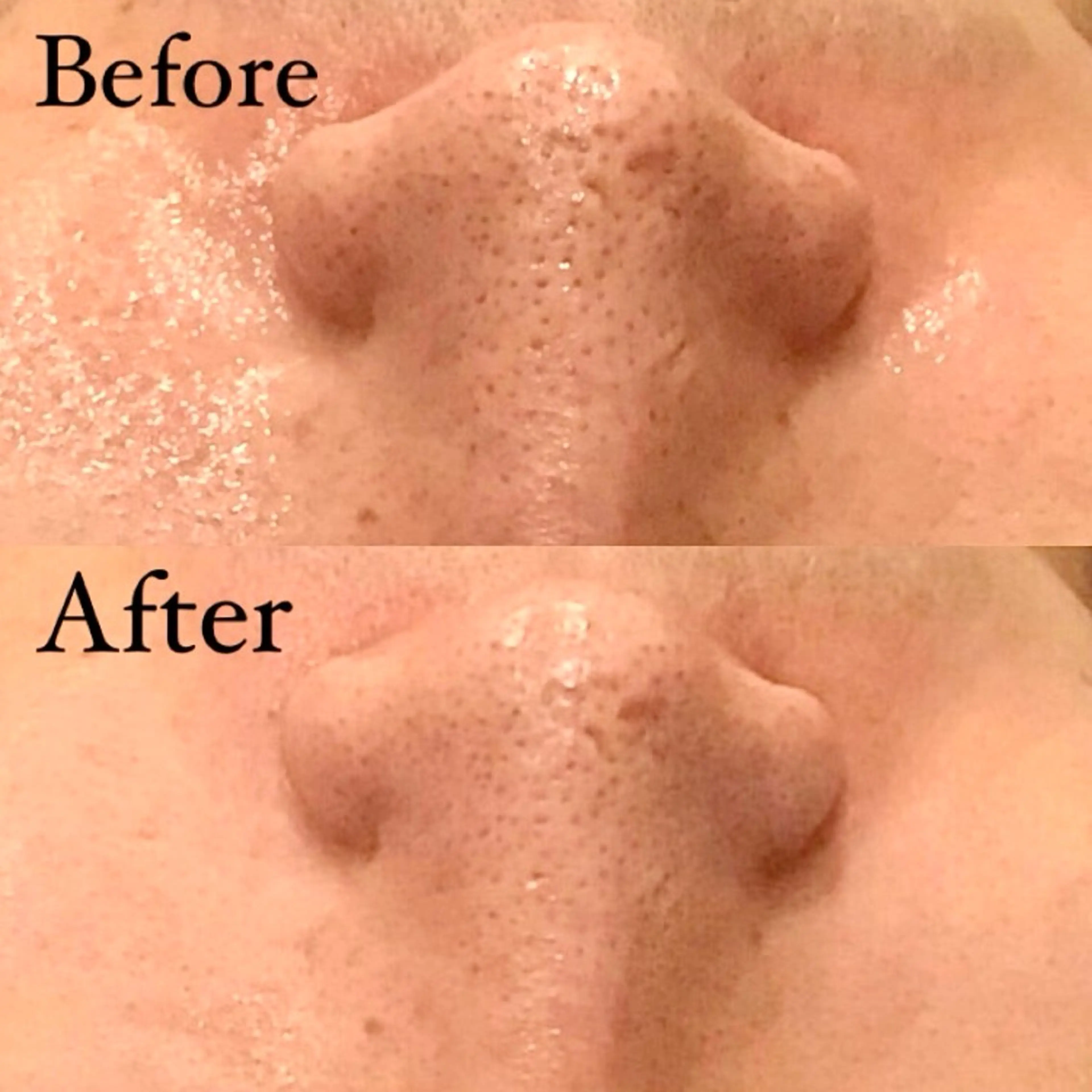 Hari Lounge恵比寿所属・chika🦋 ハリラウンジ恵比寿のエステ・リラクイメージ