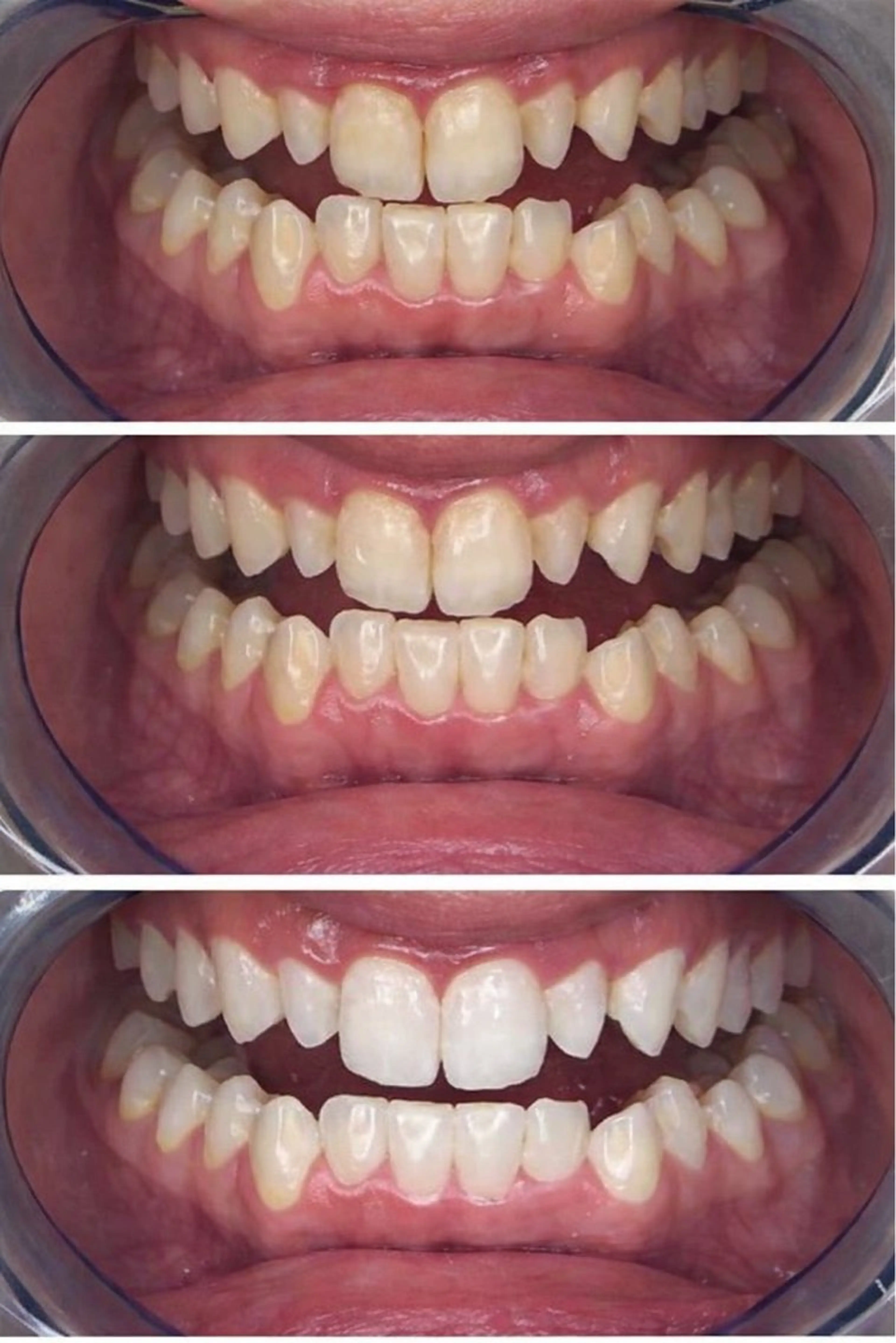 マツエク・マツパ プラチナムビューティー柏所属・【歯科提携】柏ホワイ トニングスタイルのその他イメージ