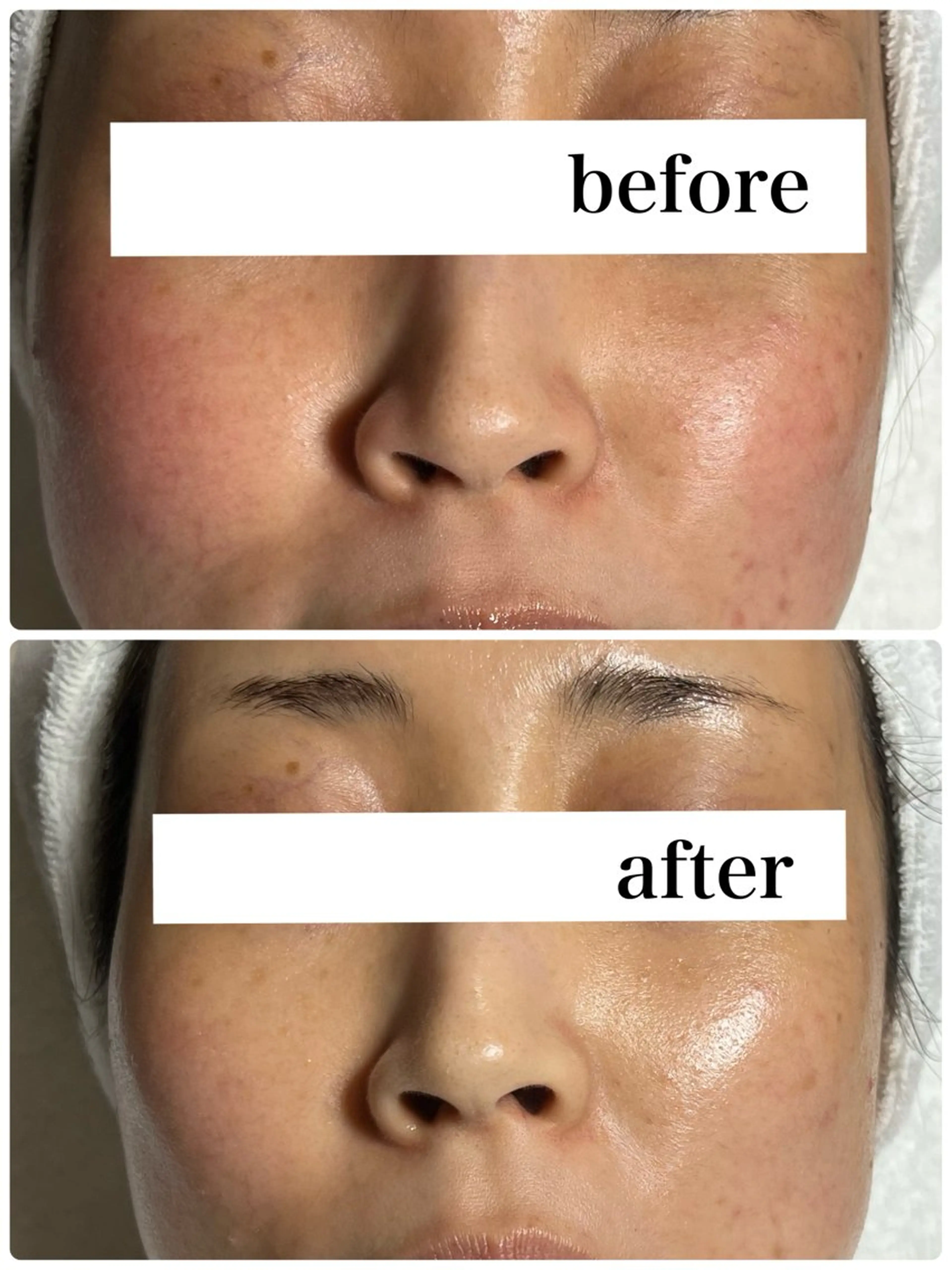 ROR Akariのエステ・リラクイメージ