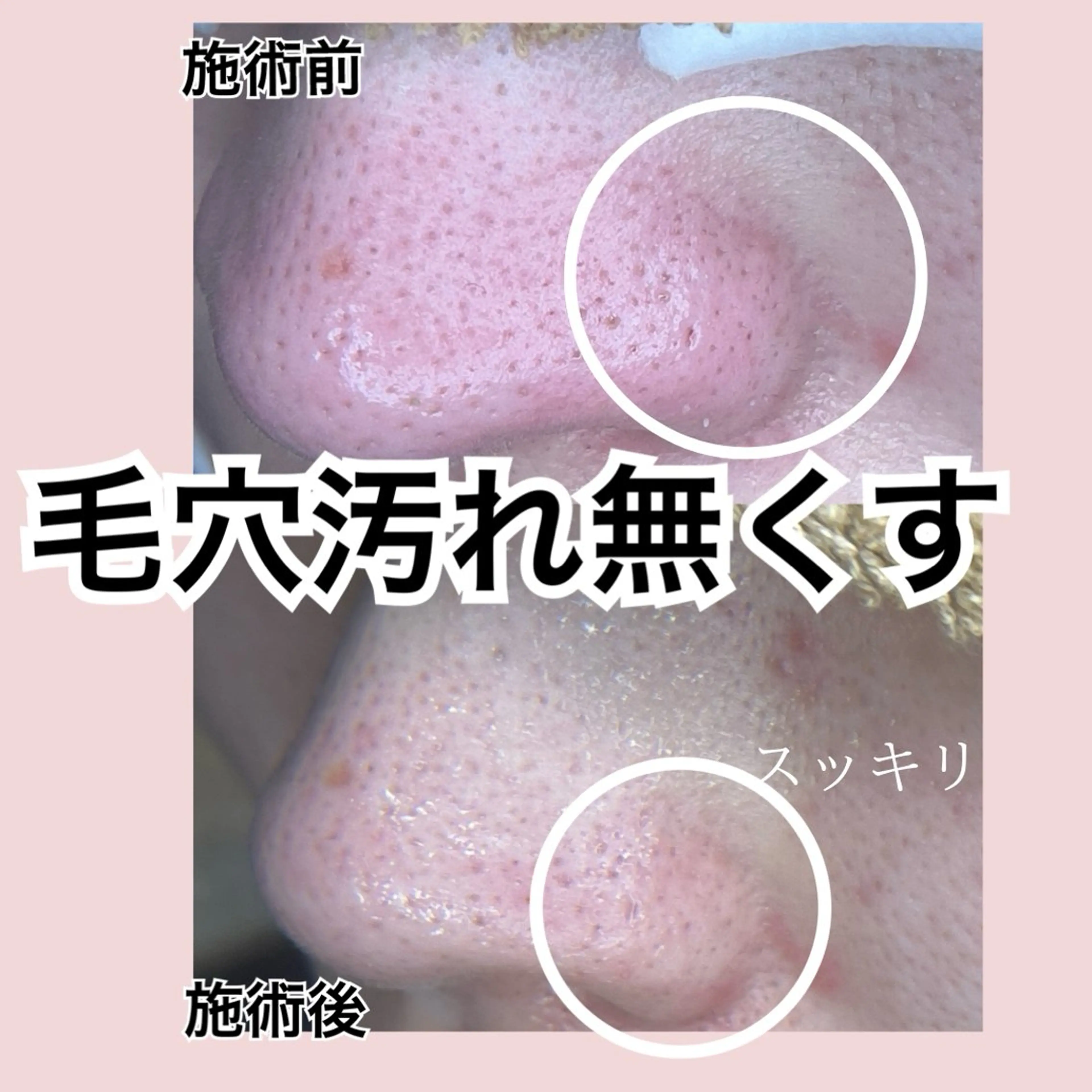 トータルビューティー サロンLilyのエステ・リラクイメージ