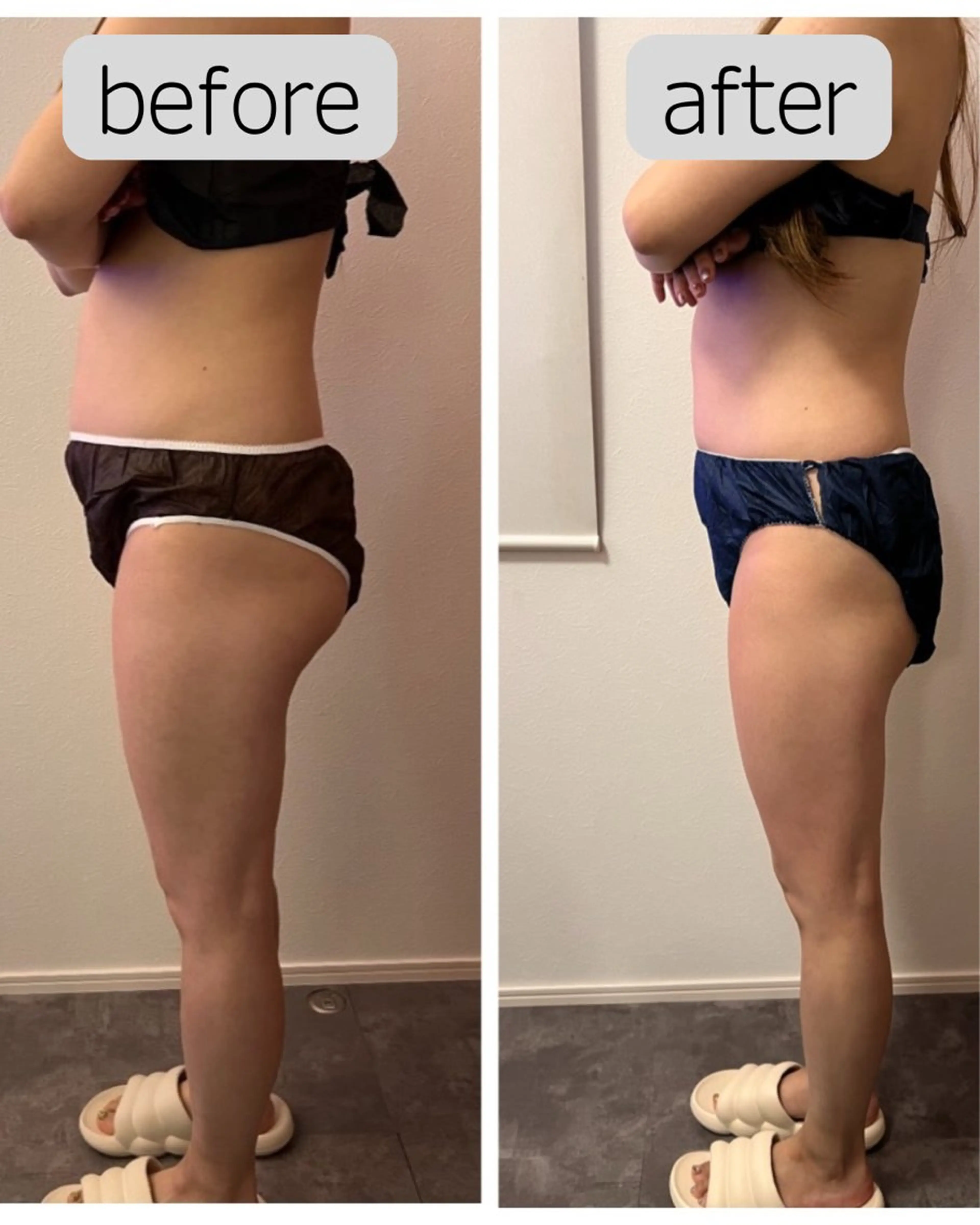 A.所属・Raviy(A.) 【痩身・韓国肌管理】のエステ・リラクイメージ