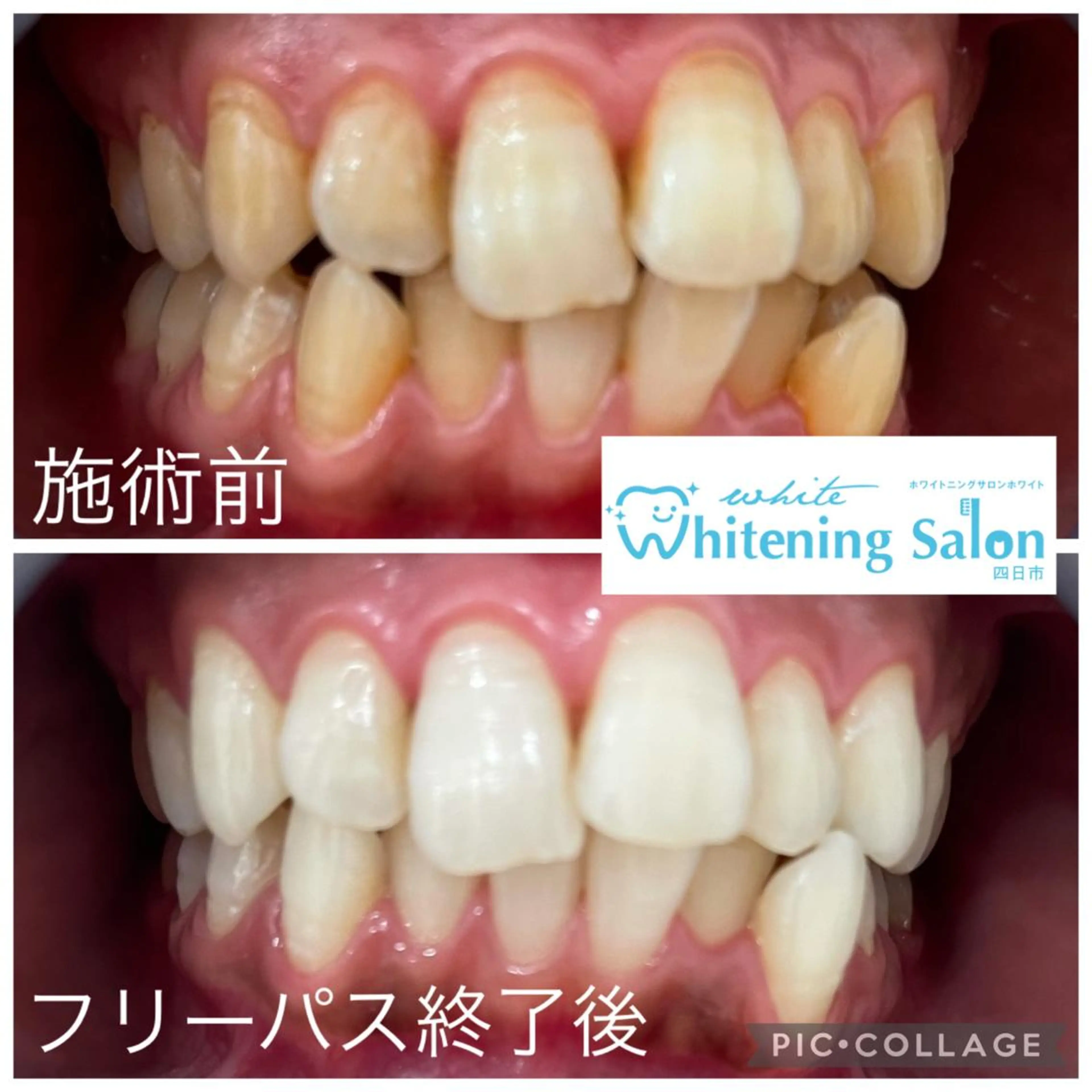 ミディアム メンズ キッズ ネイル マツエク・マツパ アイラッシュ ホワイトニング四日市のマツエク・マツパデザイン