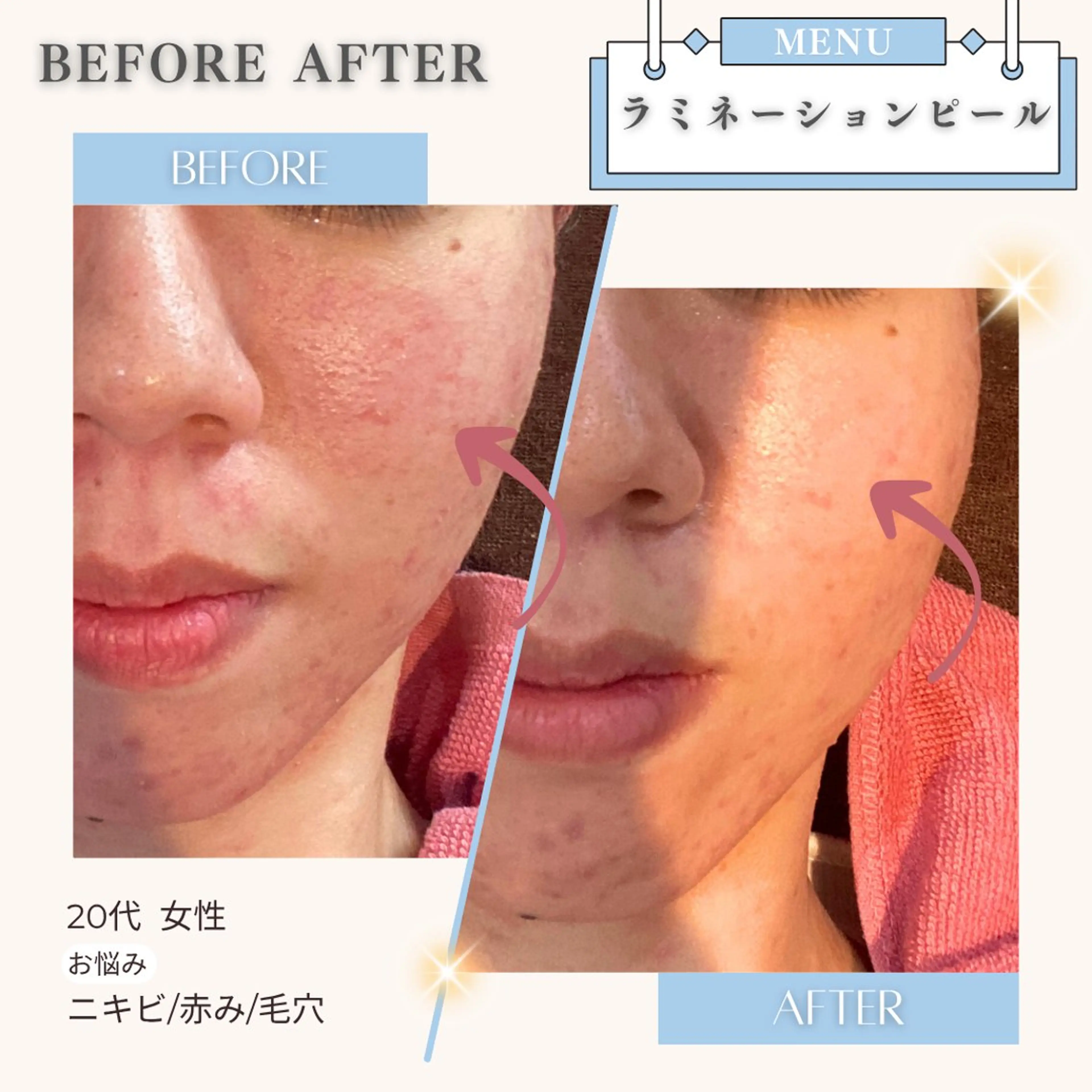 エステ リラク 美白/韓国肌管理 💎 KOTOMIのエステ・リラクイメージ