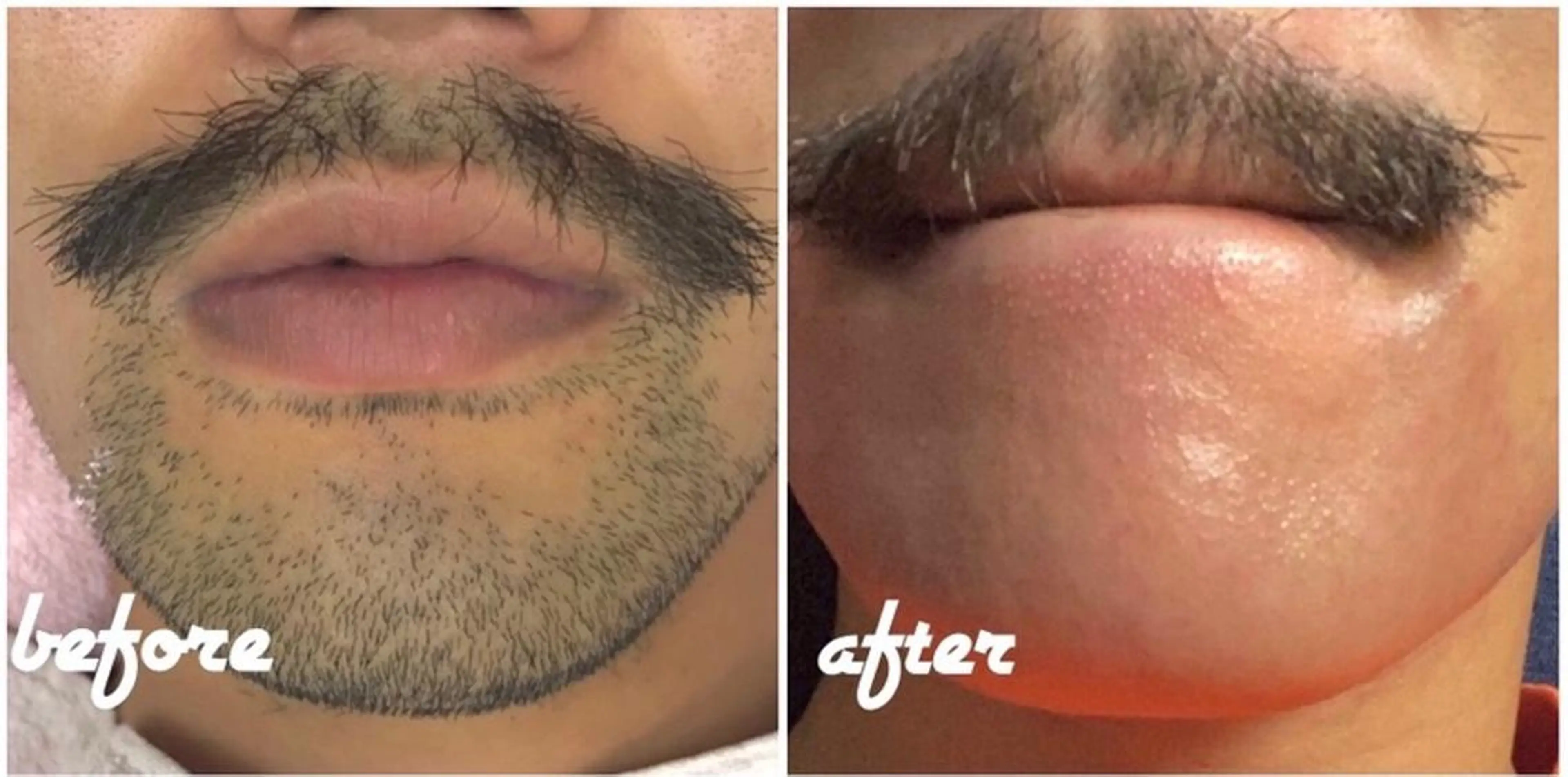 脱毛 re-born🎀 mihoのエステ・リラクイメージ