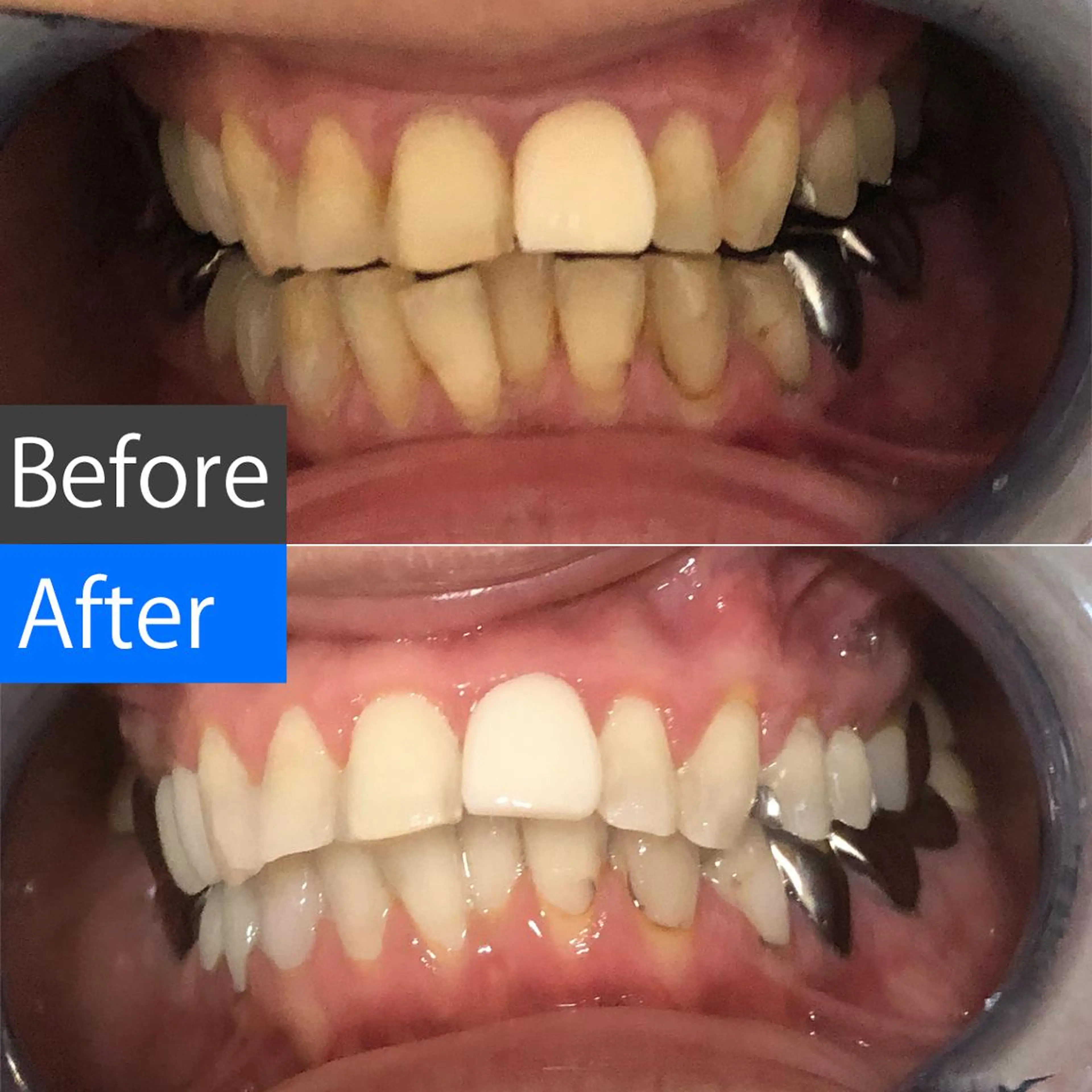 セミロング パーマ キッズ アイブロウ カラー メンズ マツエク・マツパ ヘアアレンジ ネイル ホワイト 黄色 中目黒 ホワイトニングサロンのその他イメージ