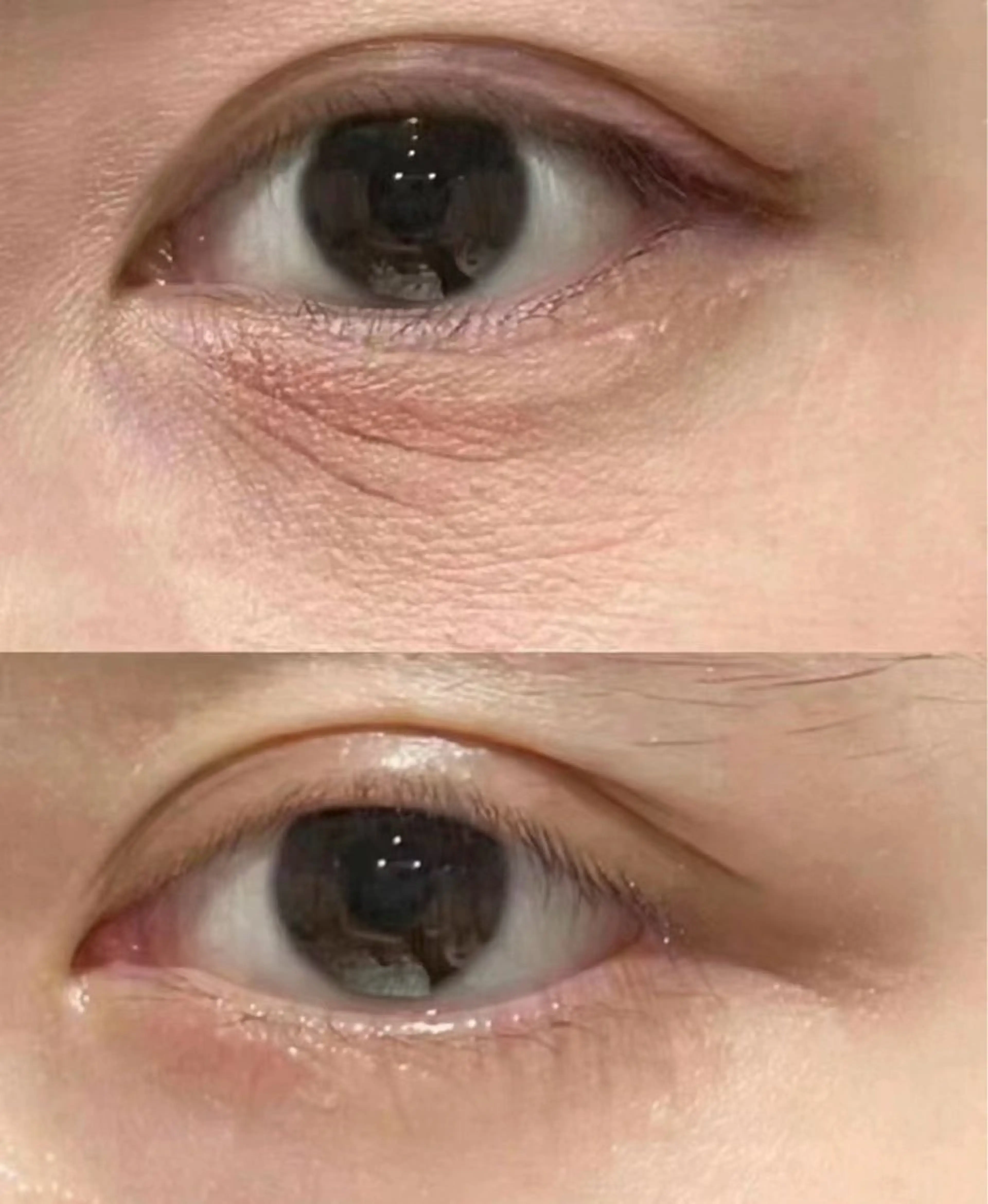 エステ リラク 愛維美水光美肌専門店所属・愛維美水光美肌専門店 メンズレディースokのエステ・リラクイメージ