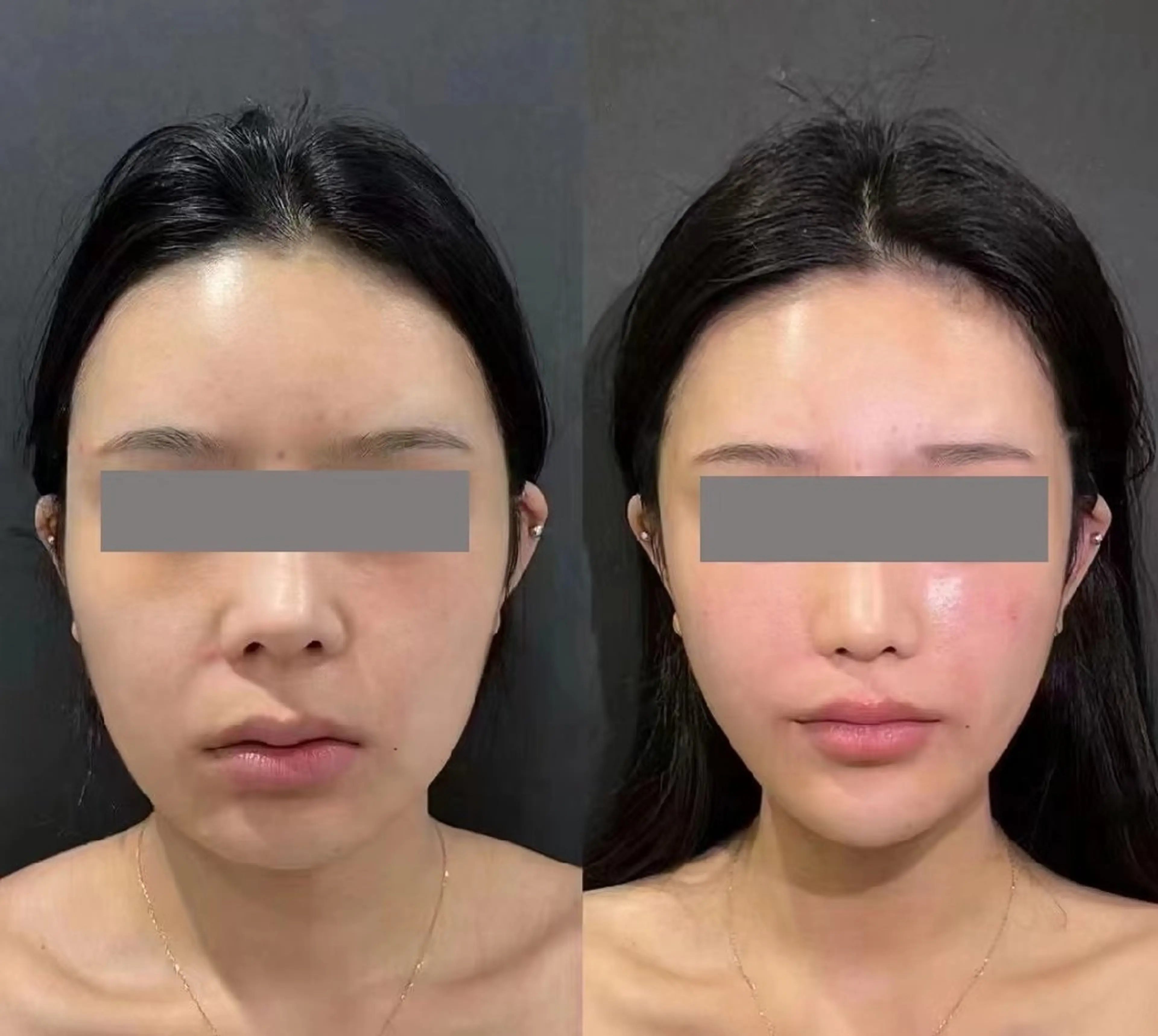 マツエク・マツパ 結婚式・ブライダル aliaハーブ水光店 エステティシャン募集のエステ・リラクイメージ