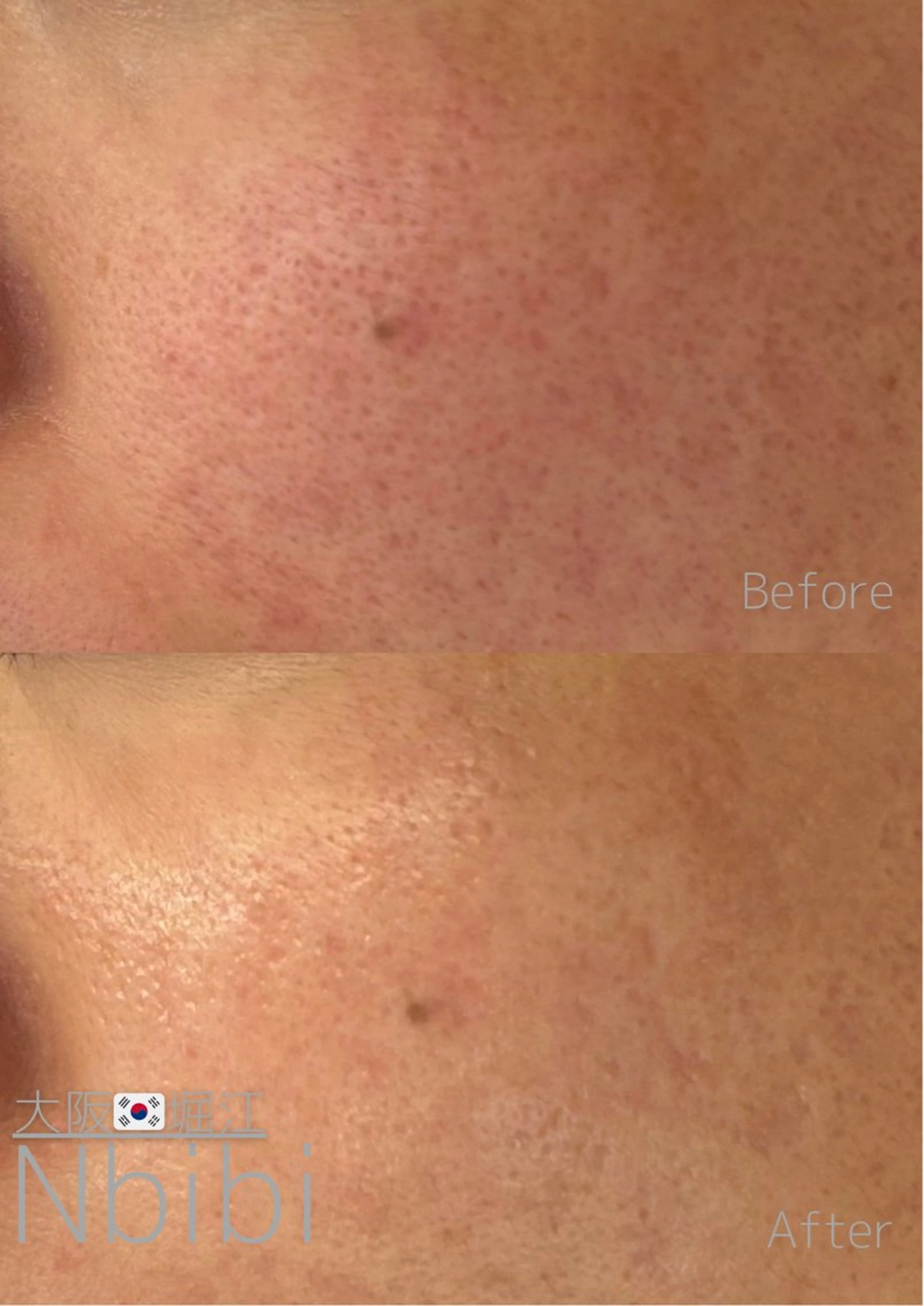 エステ 韓国🇰🇷価格 サロン_Nbibiの眉毛・アイブロウイメージ