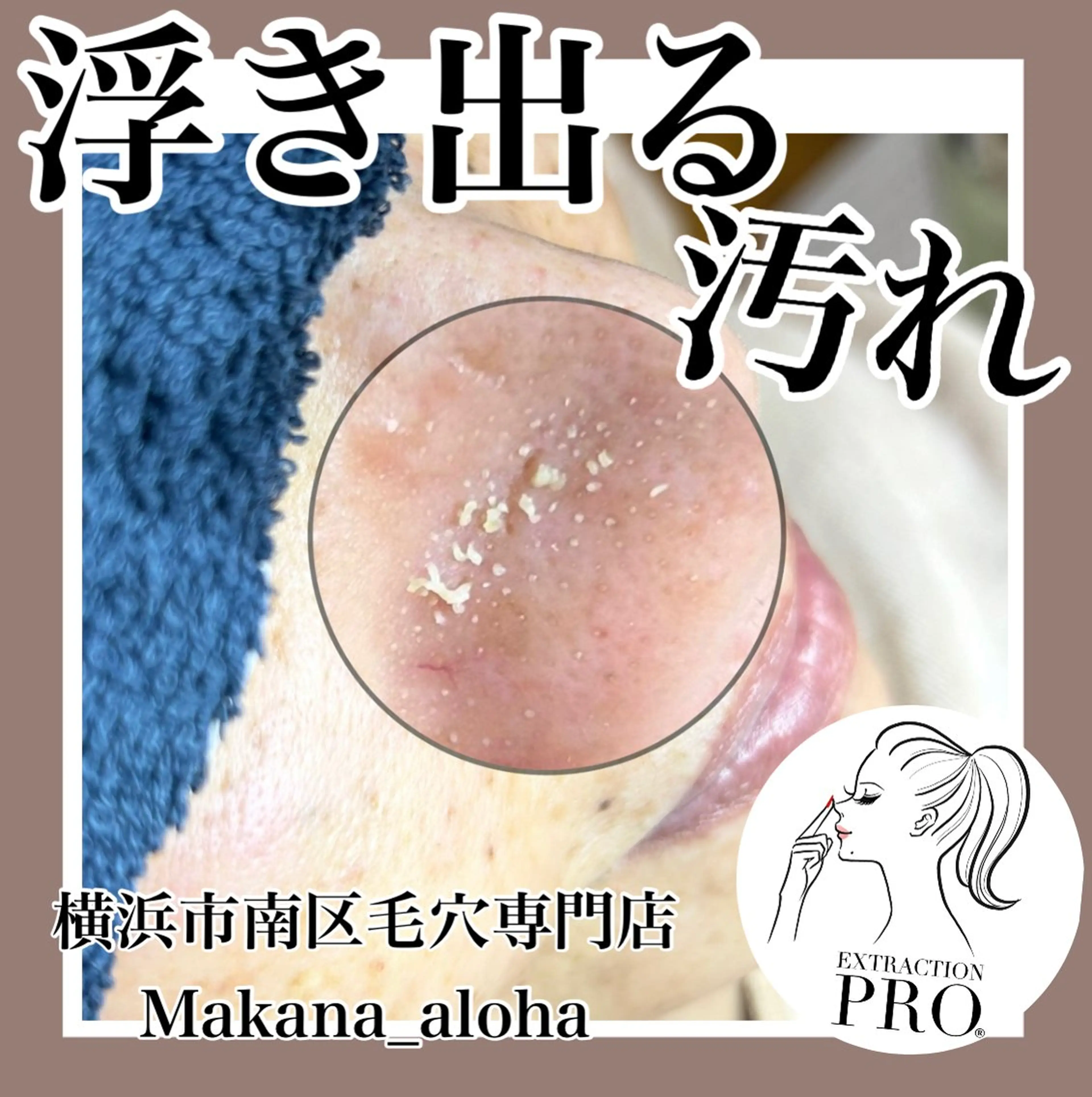 毛穴専門店 マカナアロハのエステ・リラクイメージ