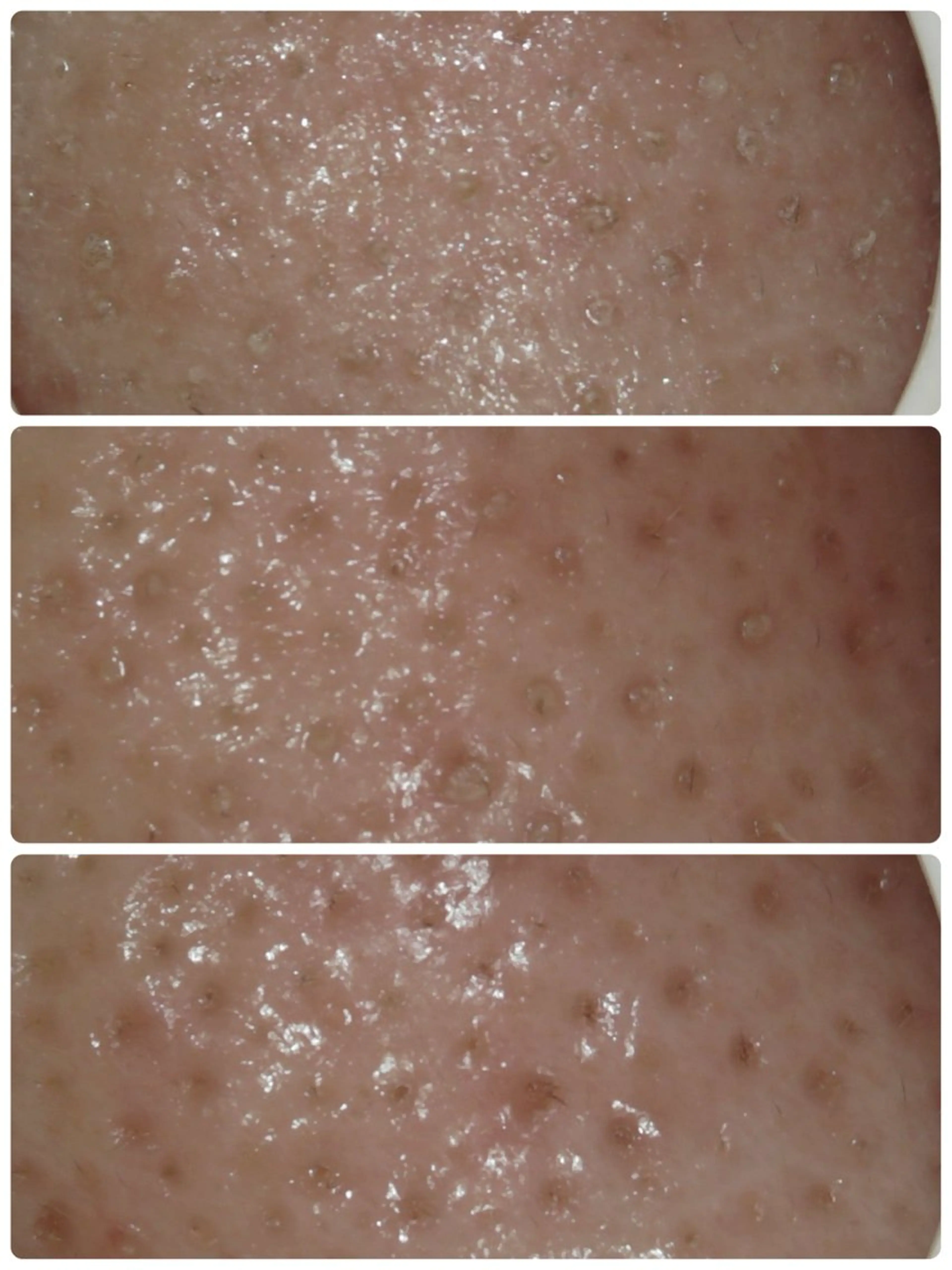 エステ リラク メナード片町 やまもと みくのエステ・リラクイメージ