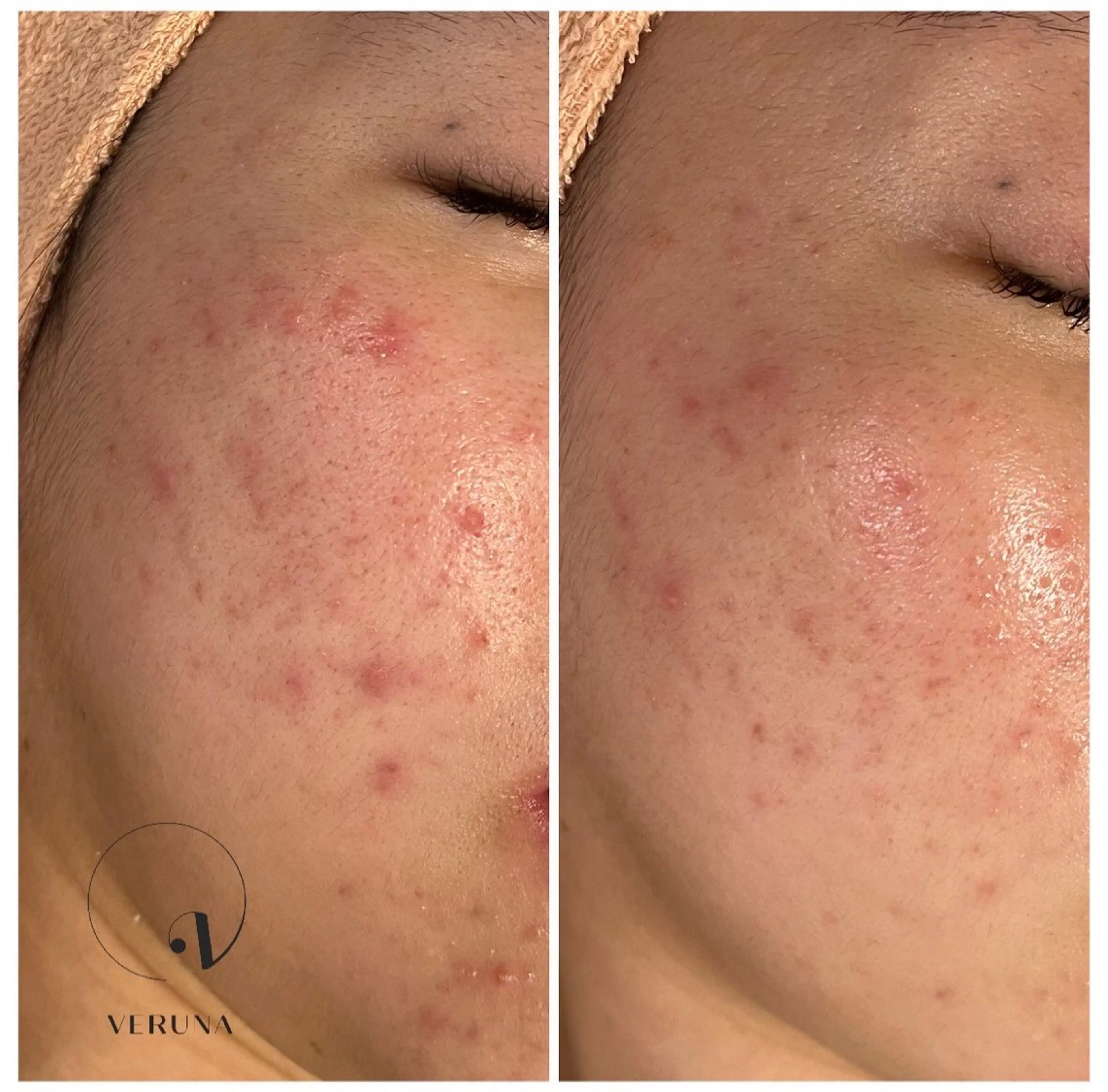 エステ ハーブピーリング専門 グランディール　武内のエステ・リラクイメージ