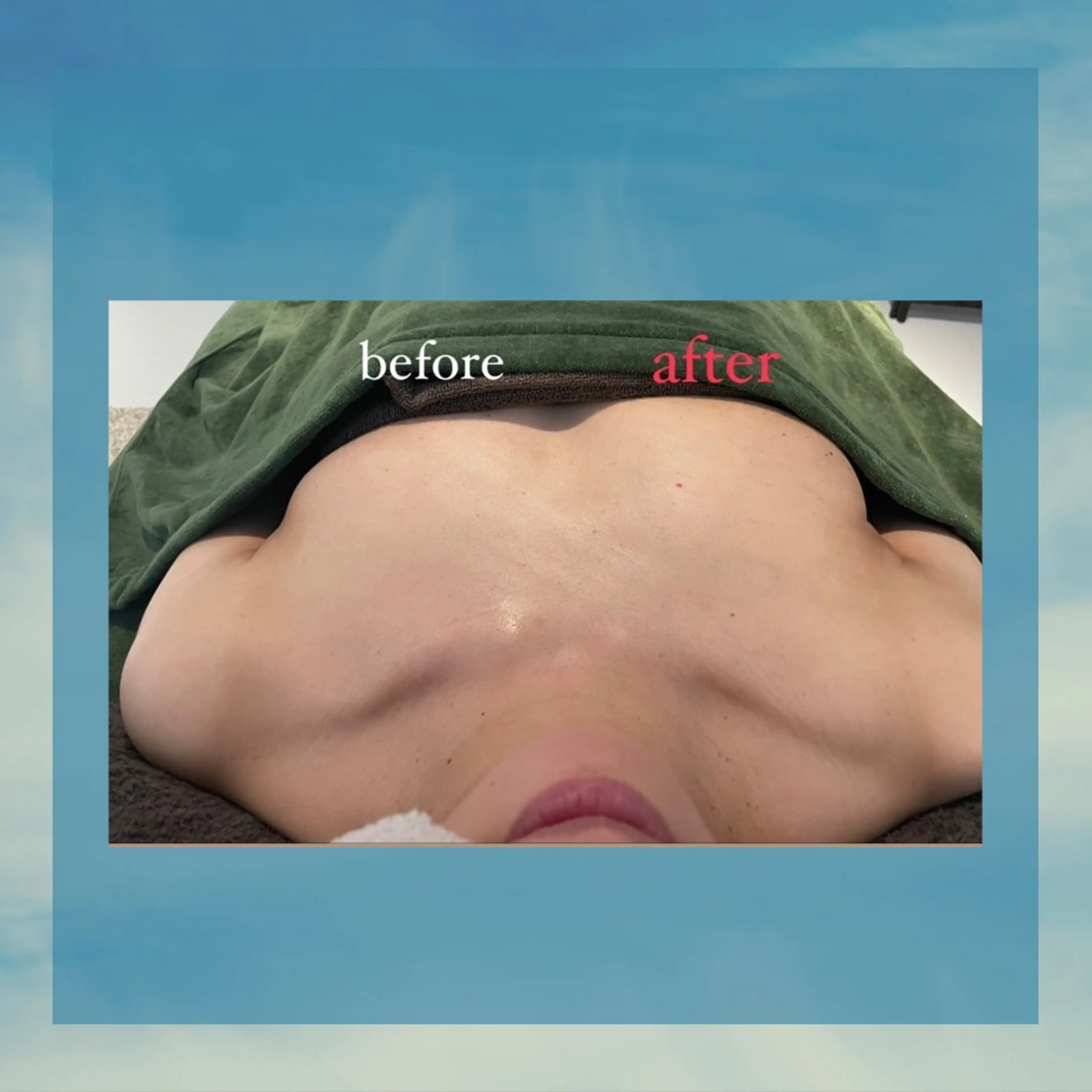 エステ Smuk.所属・いわさき りえのエステ・リラクイメージ