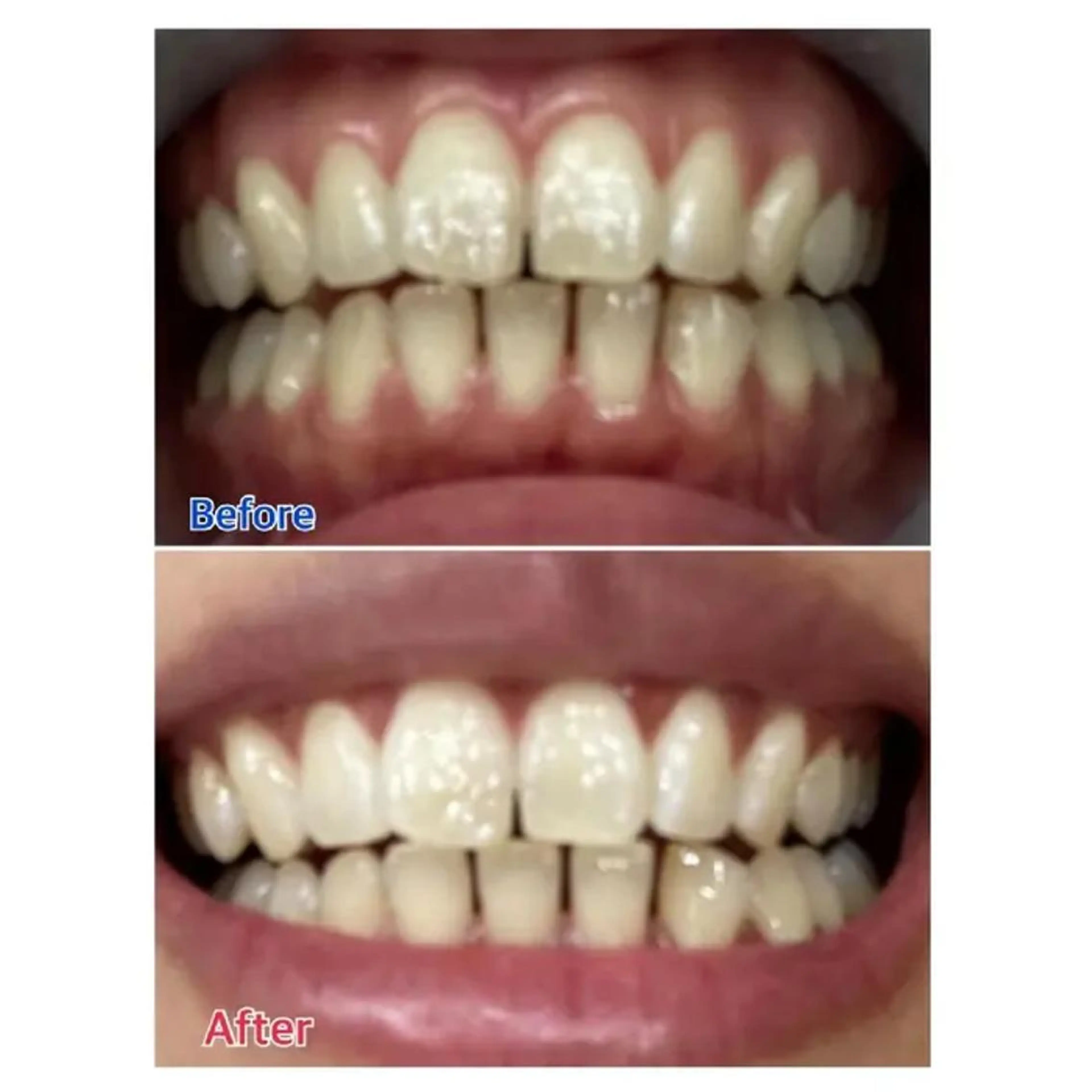 M渋谷 ホワイトニングのエステ・リラクイメージ