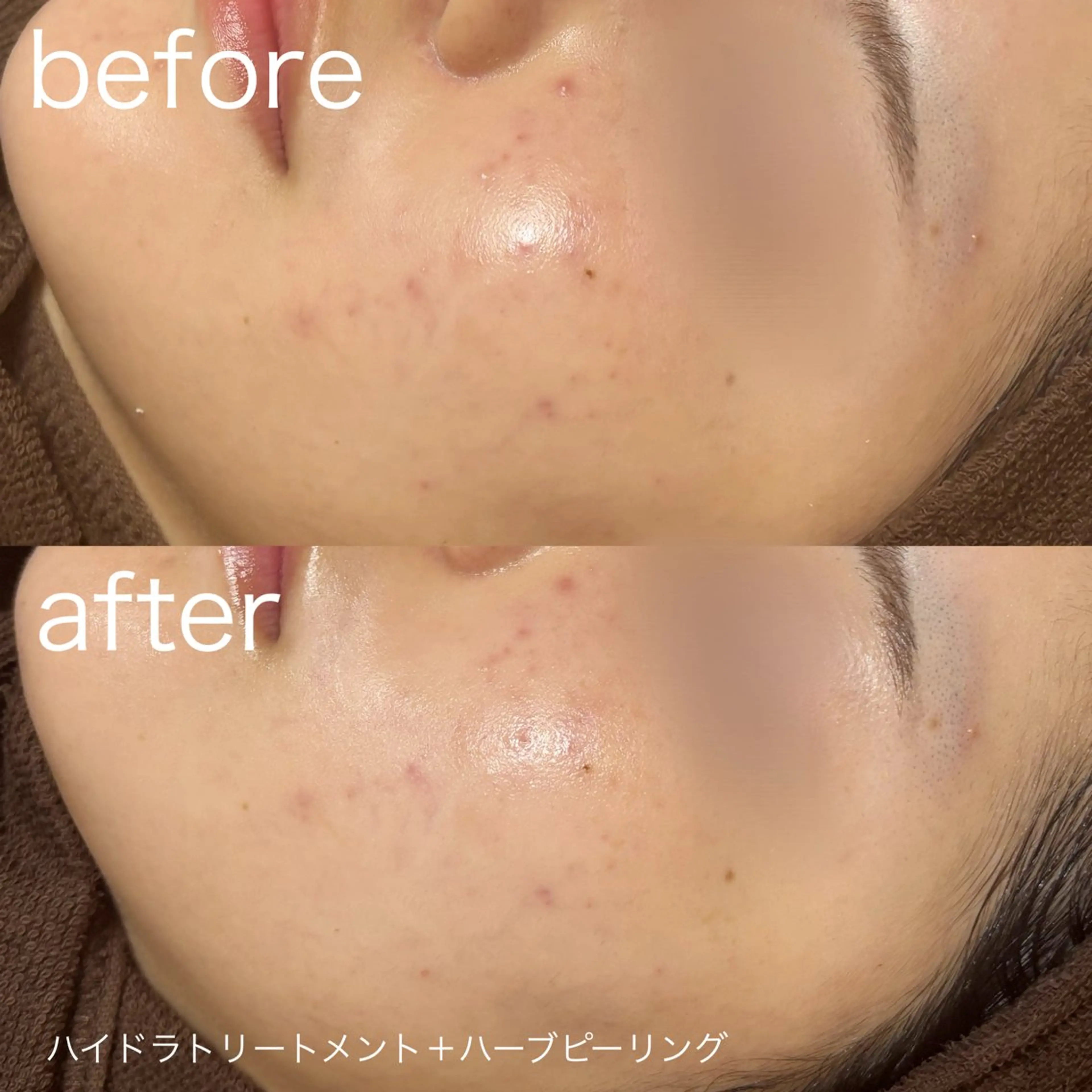 lulularico Yuのエステ・リラクイメージ
