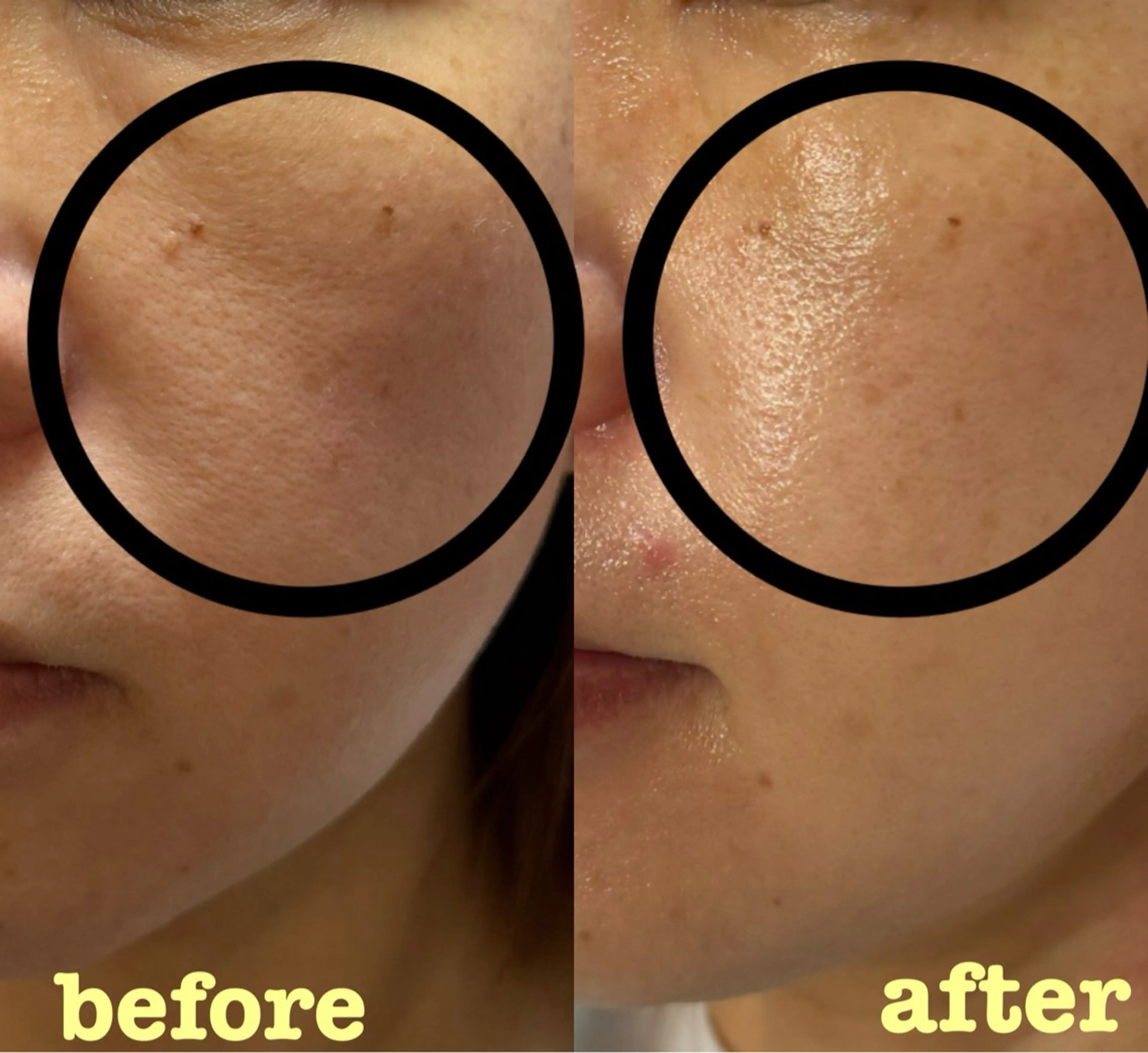 エステ De I'mデアイム西宮ナリスビューティースタジオ所属・池西 祐稀のエステ・リラクイメージ