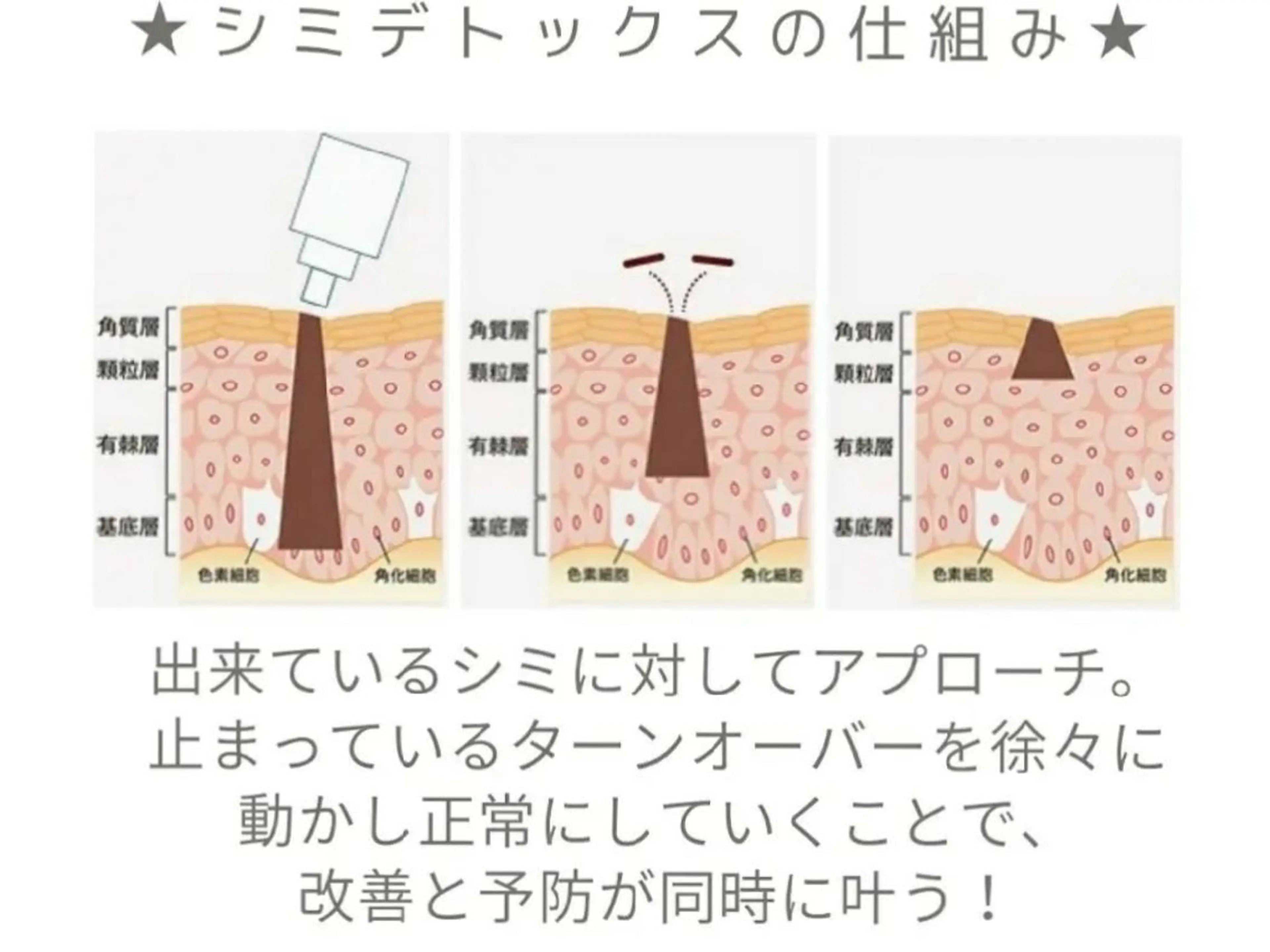 シミケア5箇所お試しの写真