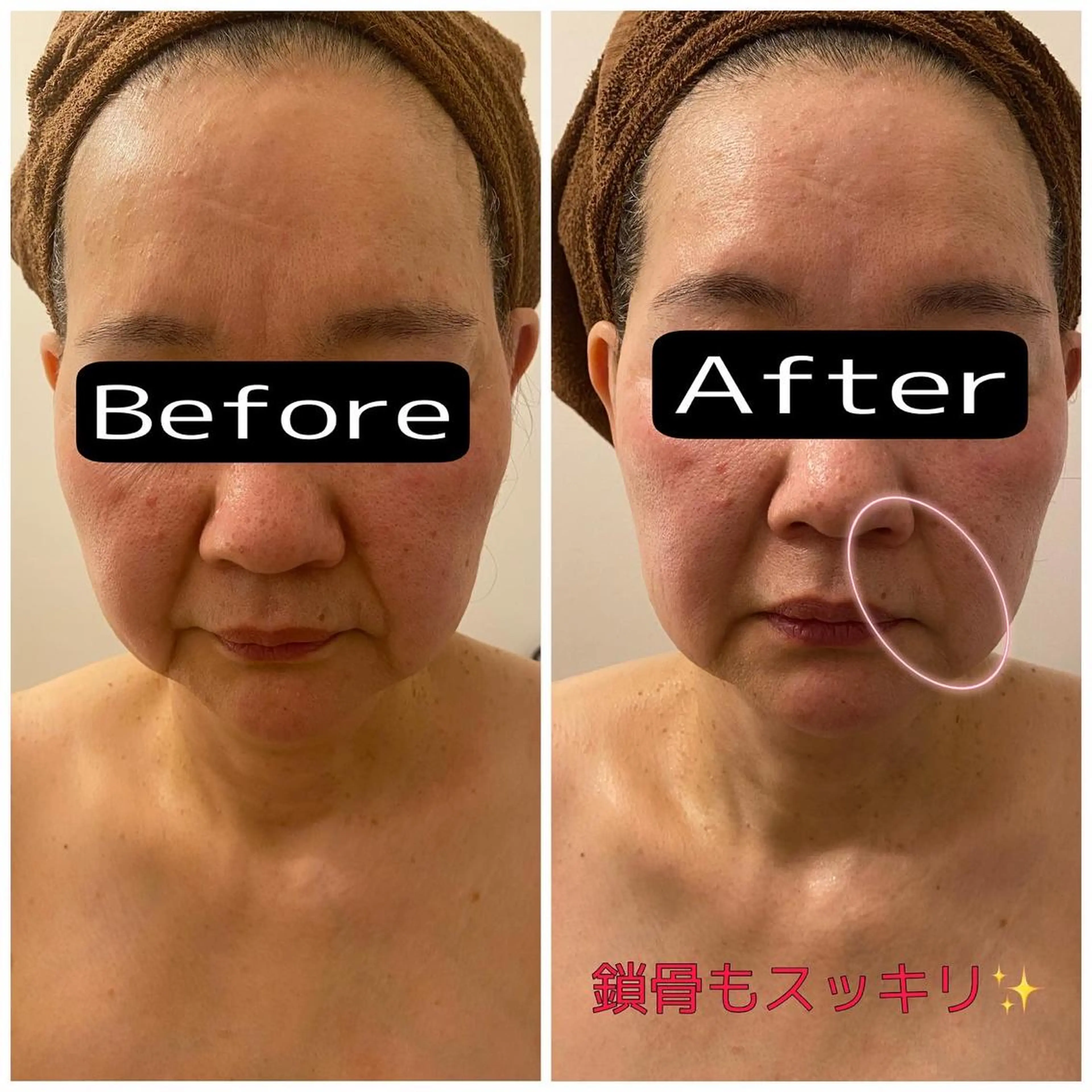 エステ リラク 痩身リラク専門サロン 〜LUCIALL 〜のエステ・リラクイメージ