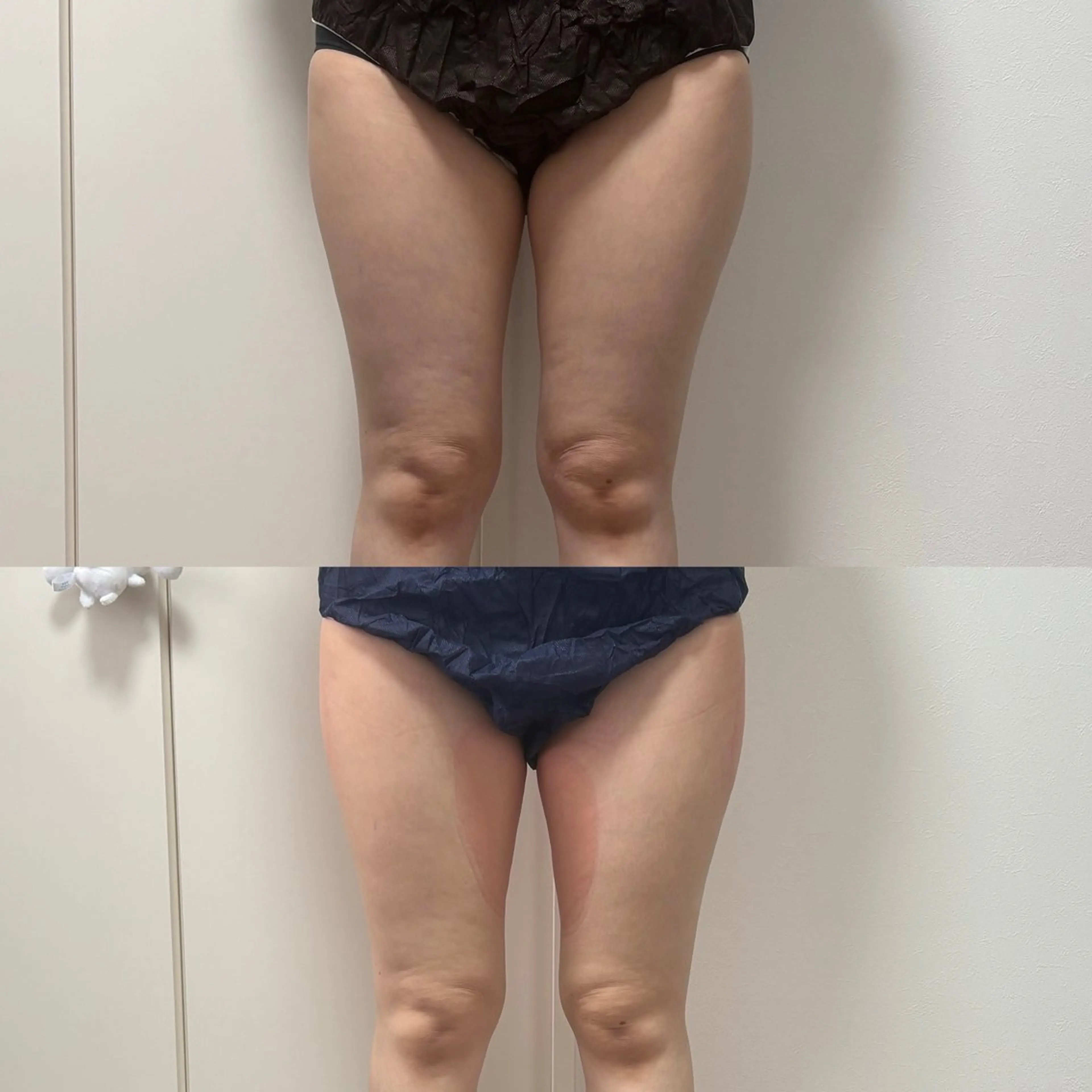 エステ 石巻 冷却痩身 Miiju. 鈴木のエステ・リラクイメージ