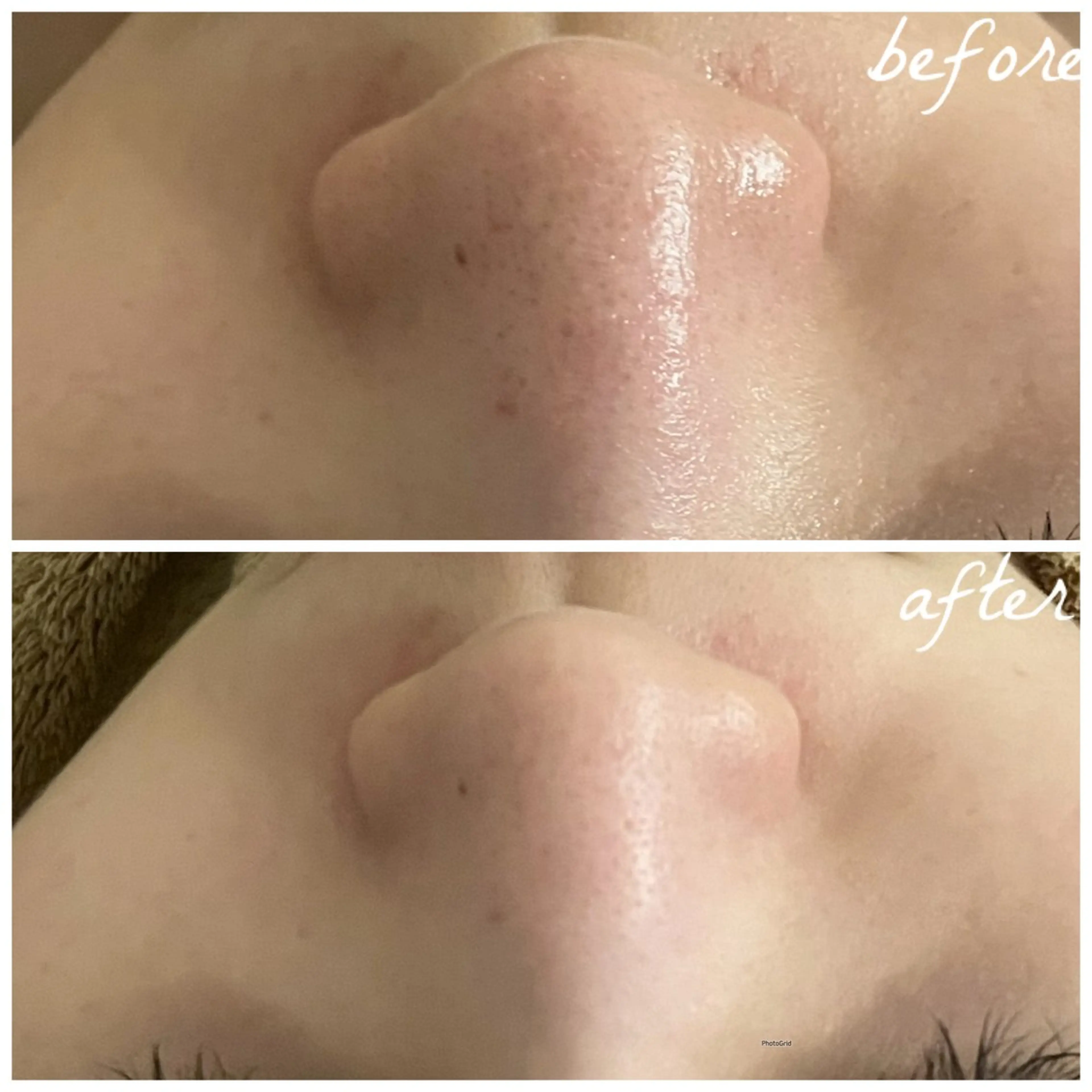 メンズ エステ メナード岐阜市茜部 杉浦のエステ・リラクイメージ