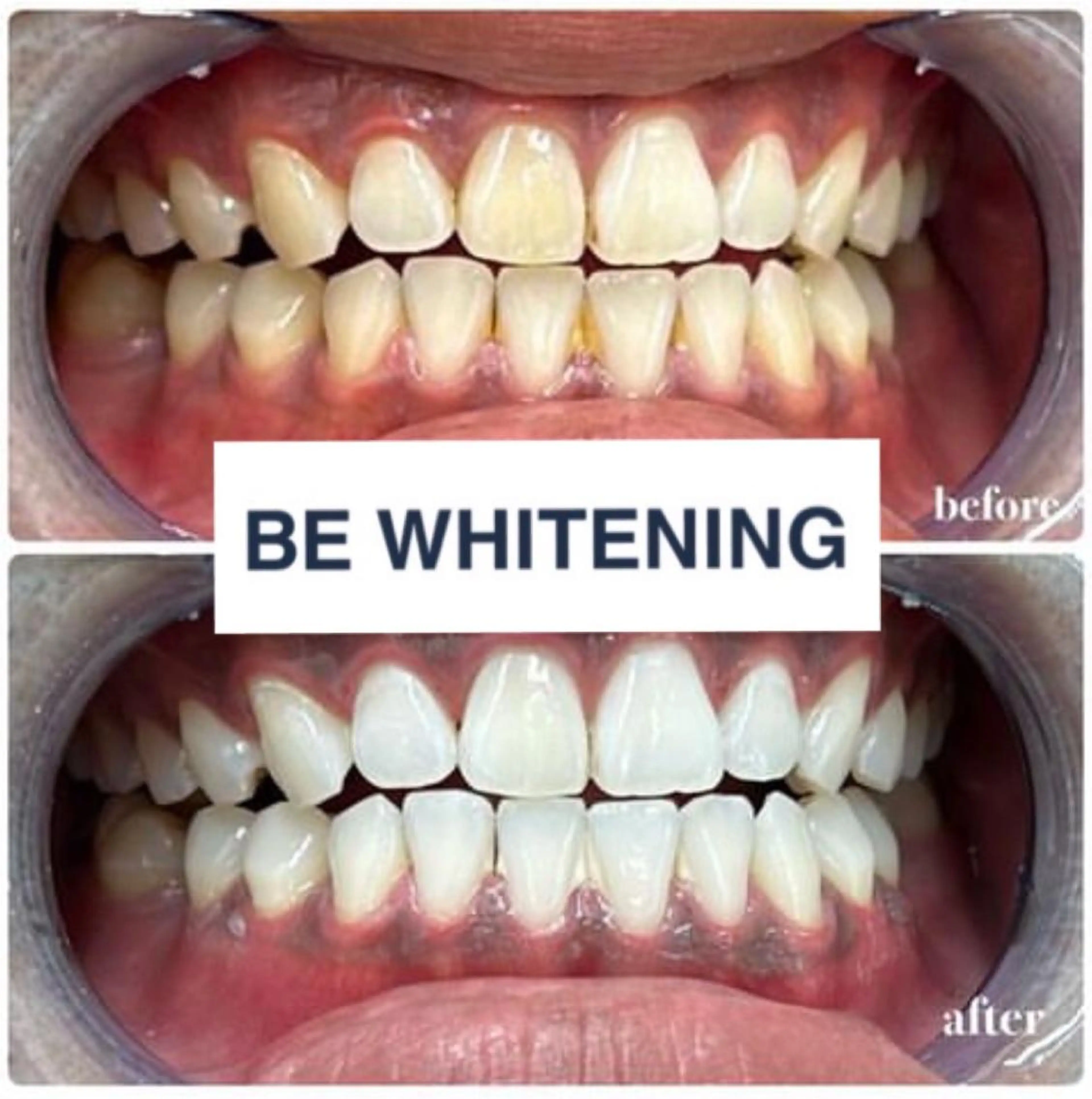 その他 ホワイトニング専門店 ビーホワイト金山のその他イメージ