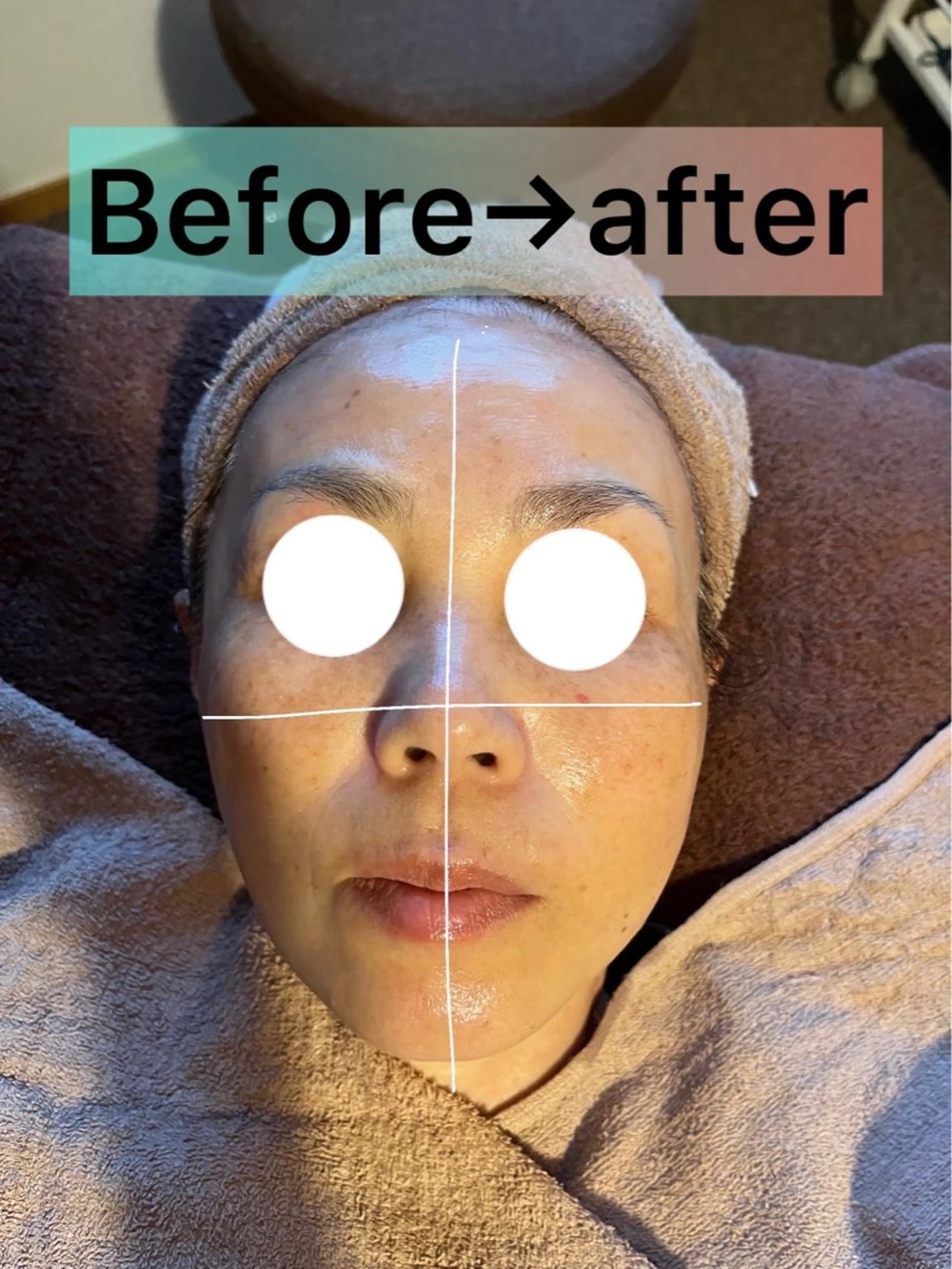 お顔の凝りむくみを潰して排出フェイシャル80分（リフトup・小顔にしたい方はこちら）の写真