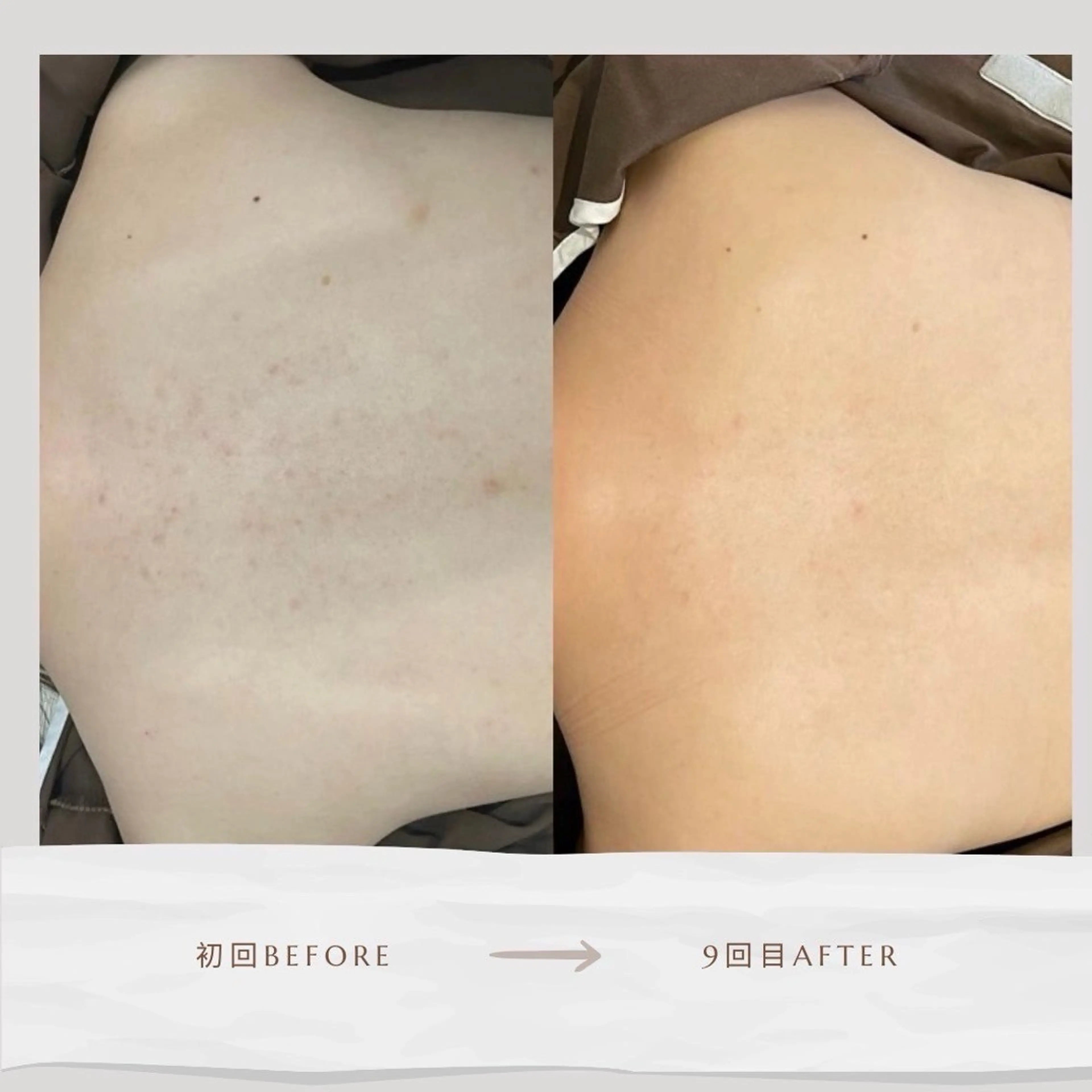 Life Salon別府店のエステ・リラクイメージ