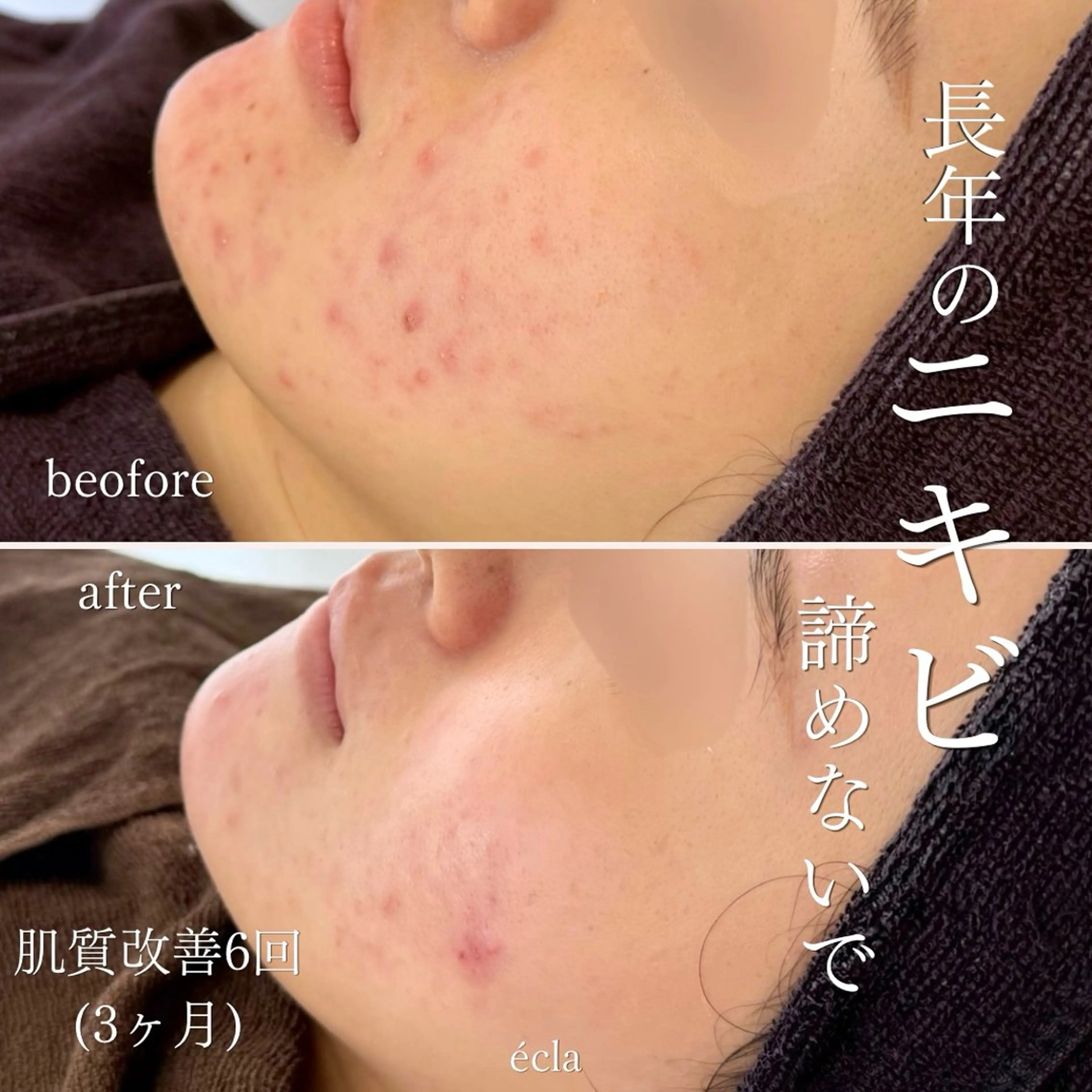 エステ yukiko/美容師 肌質改善/中崎町のエステ・リラクイメージ