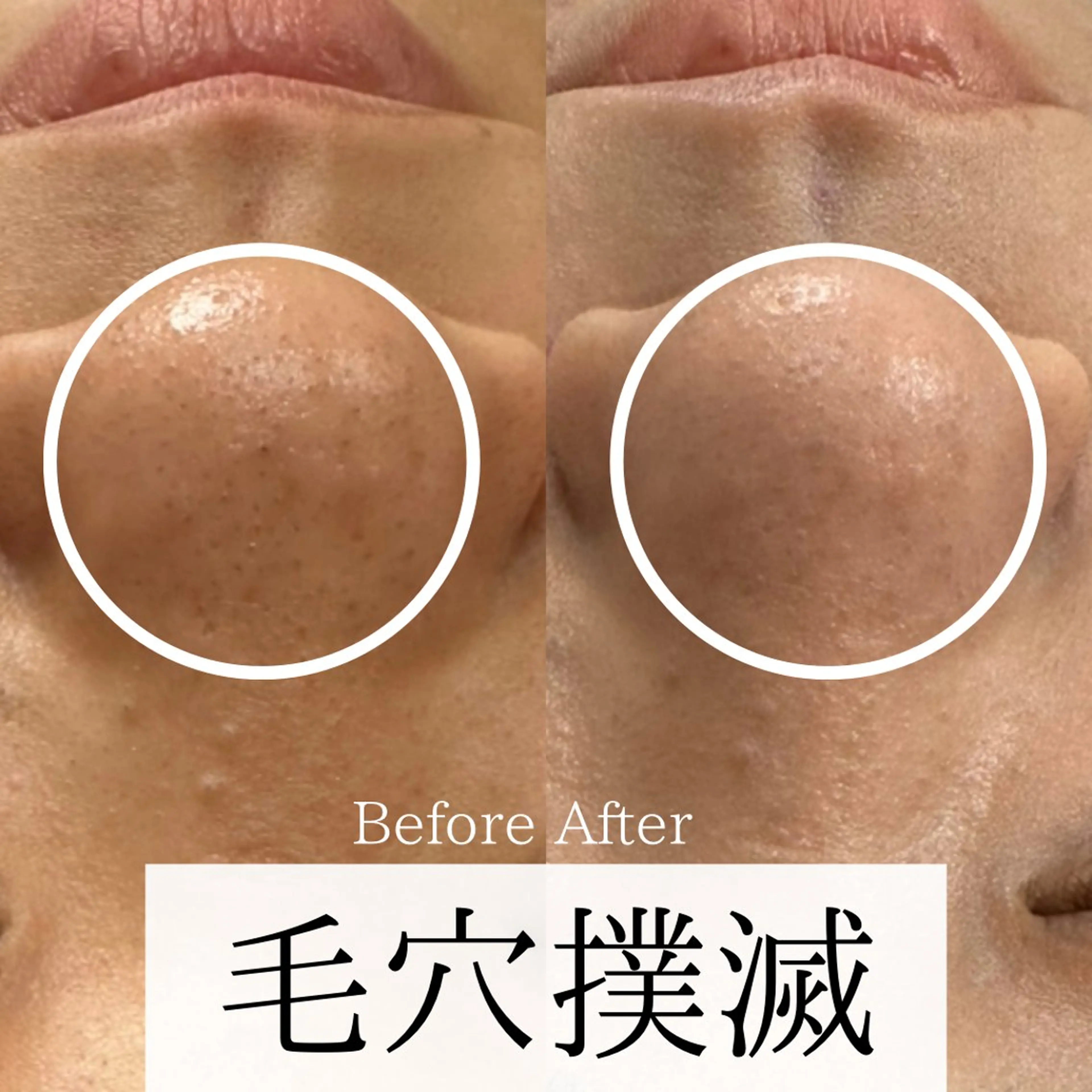 エステ リラク Ginza Charerのエステ・リラクイメージ