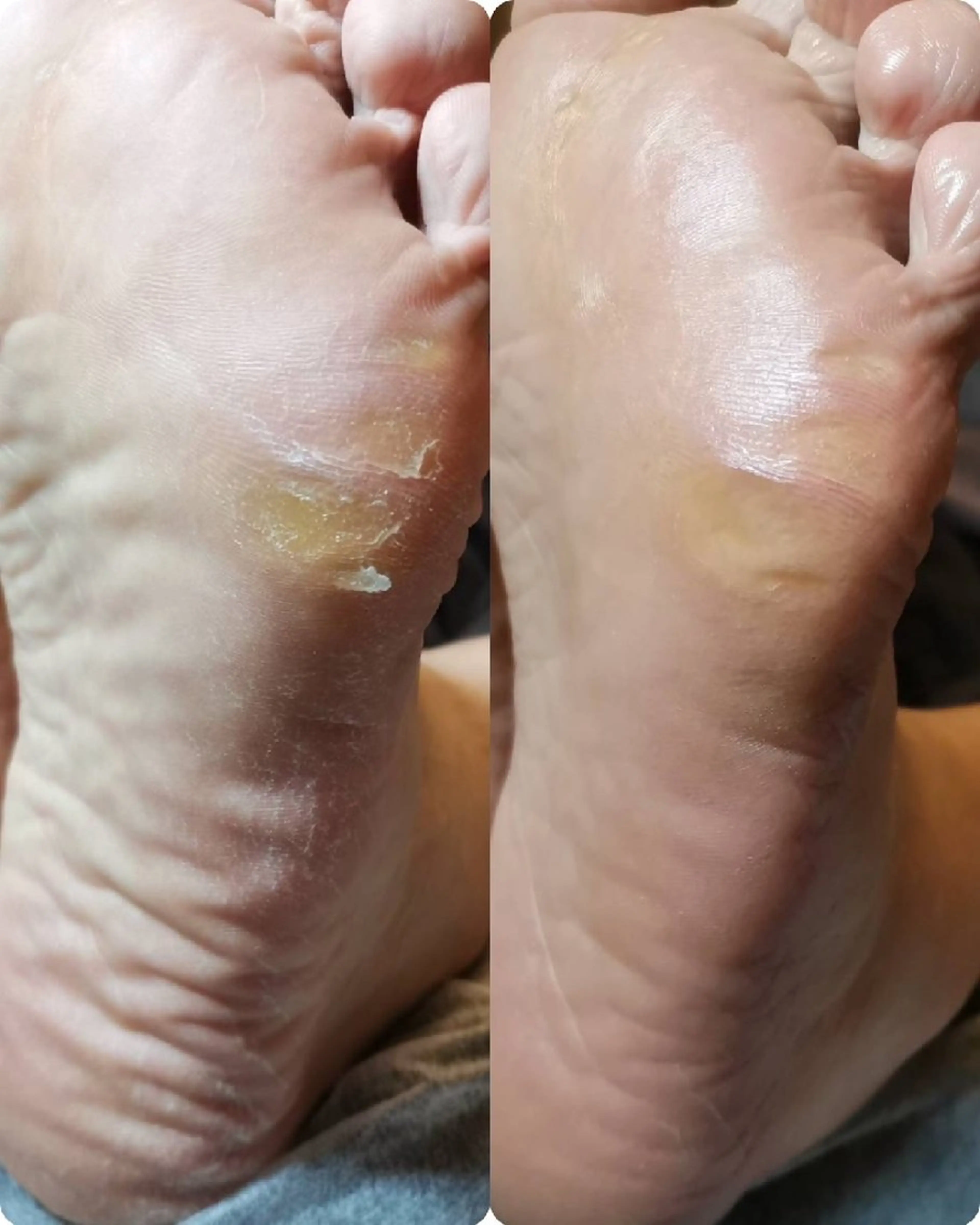 ネイル ROUN' 齋藤のエステ・リラクイメージ