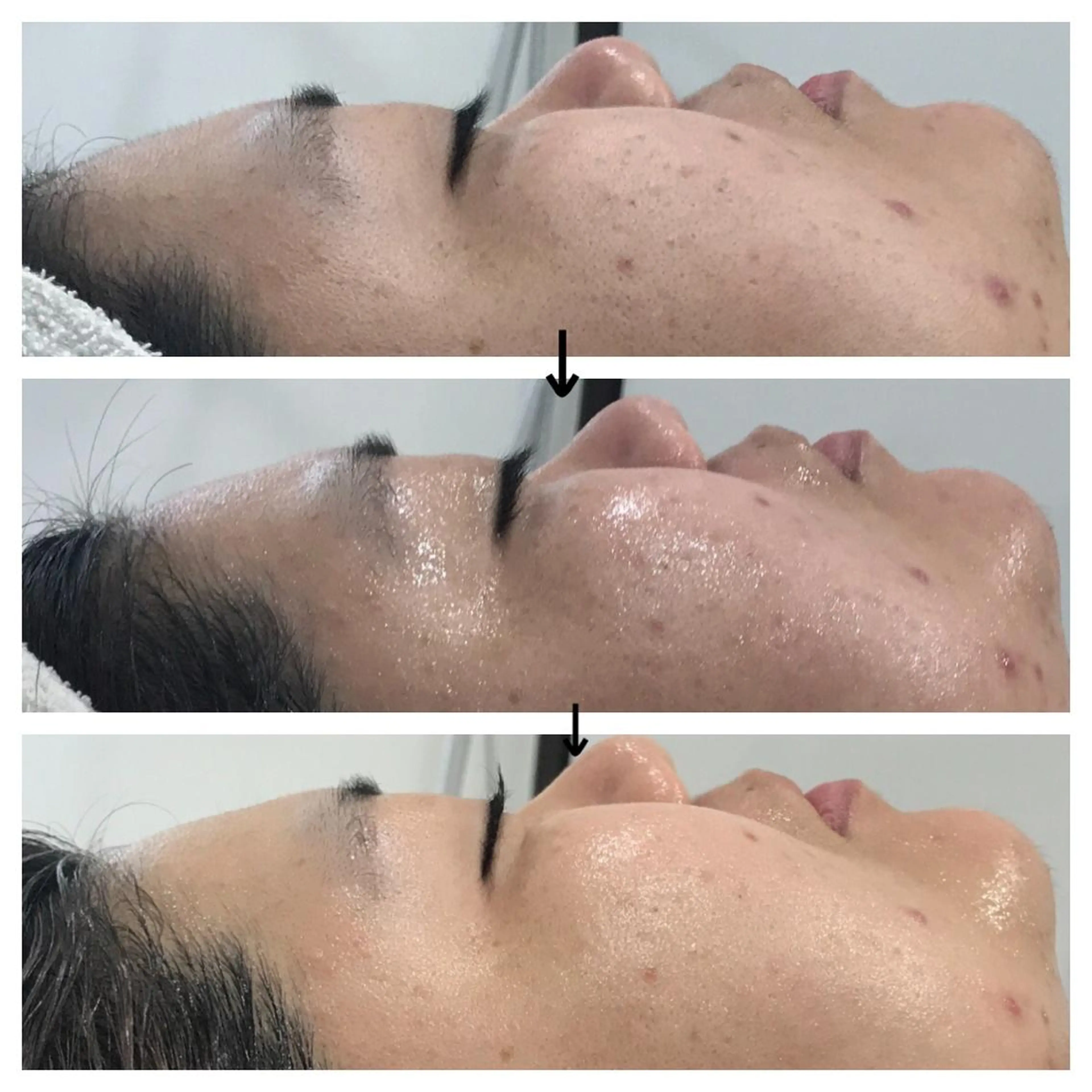 ビューティー ミロワールのエステ・リラクイメージ