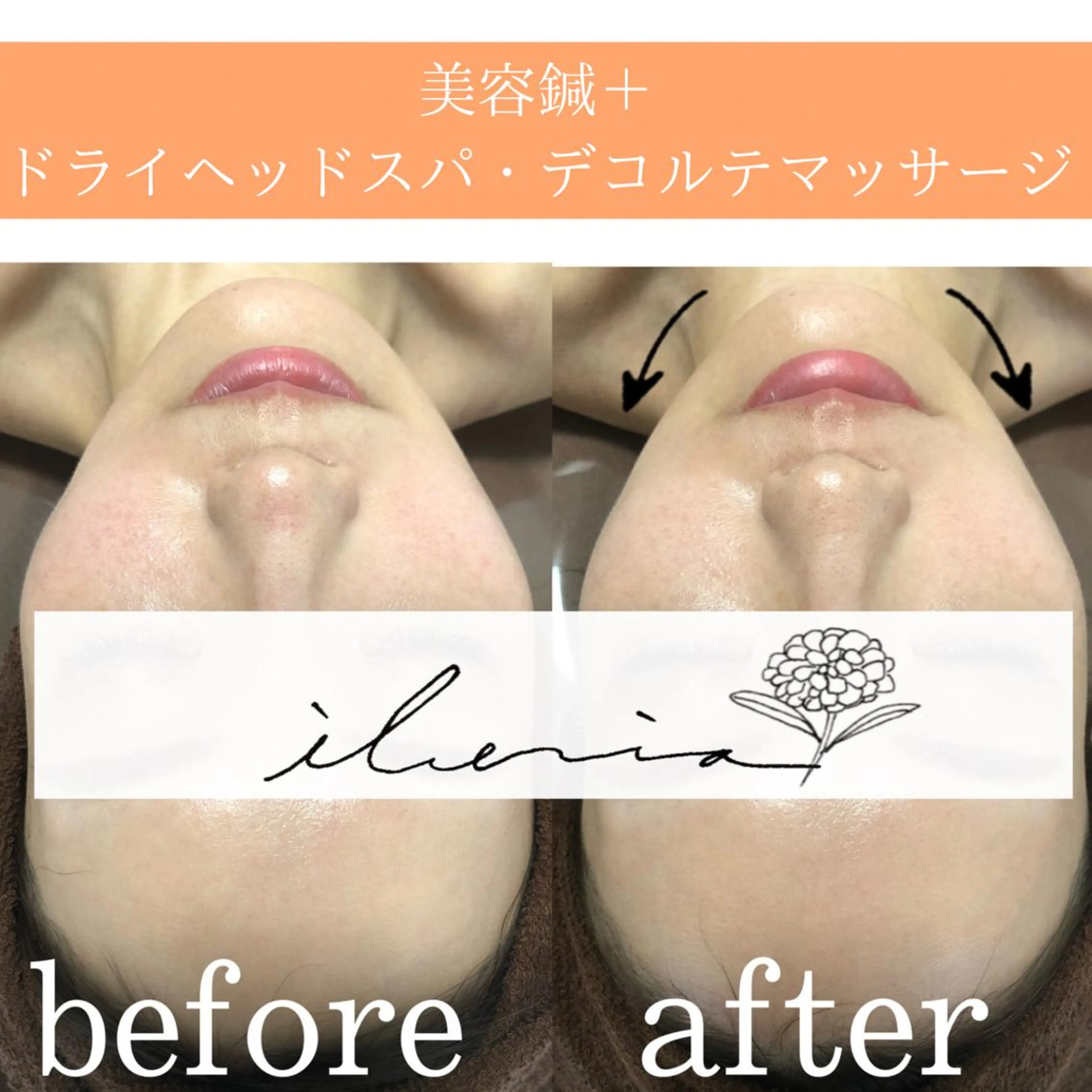 心斎橋痩身ダイエット 韓国.美容鍼.小顔のエステ・リラクイメージ