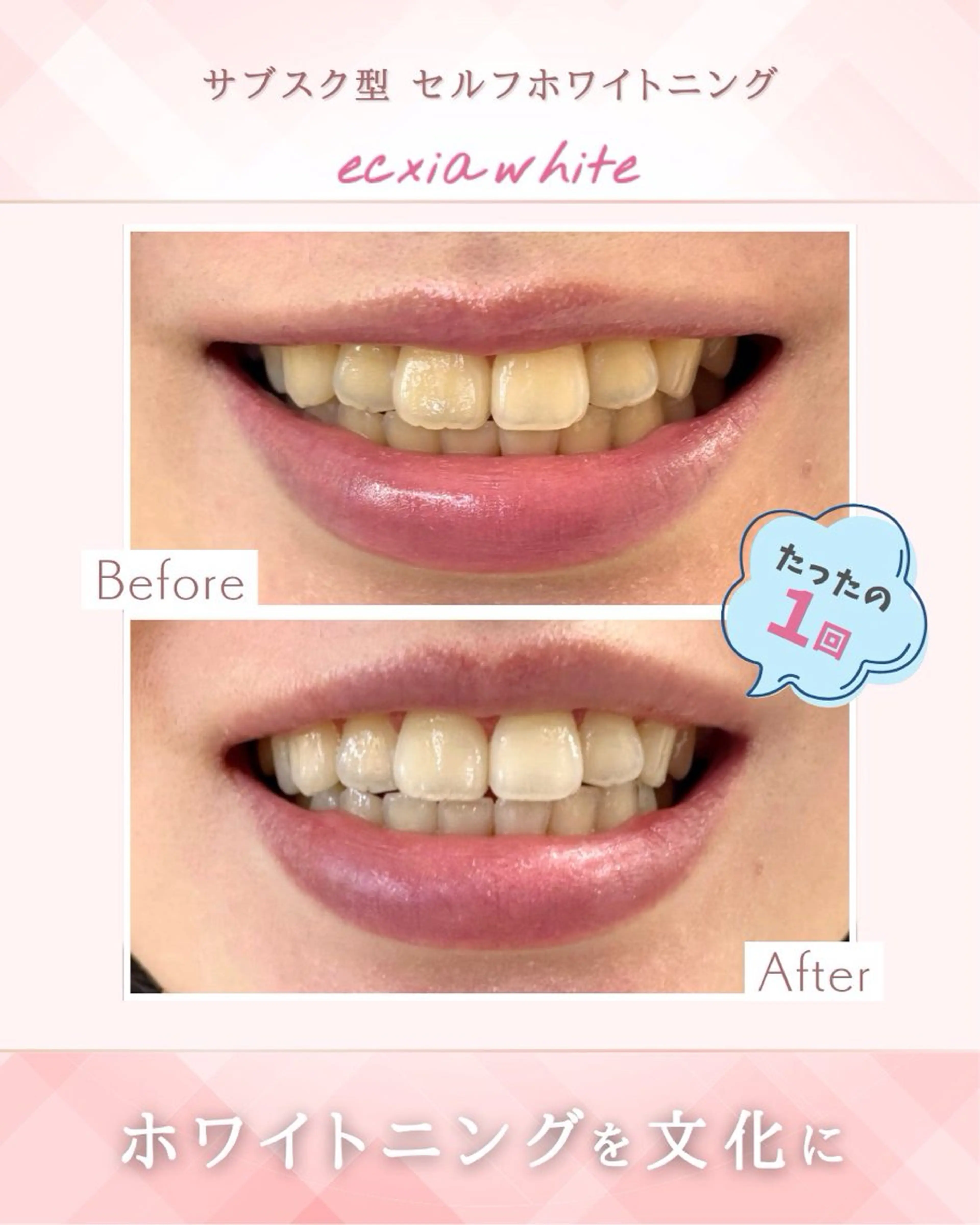 エクシア ホワイトニング西条店のその他イメージ