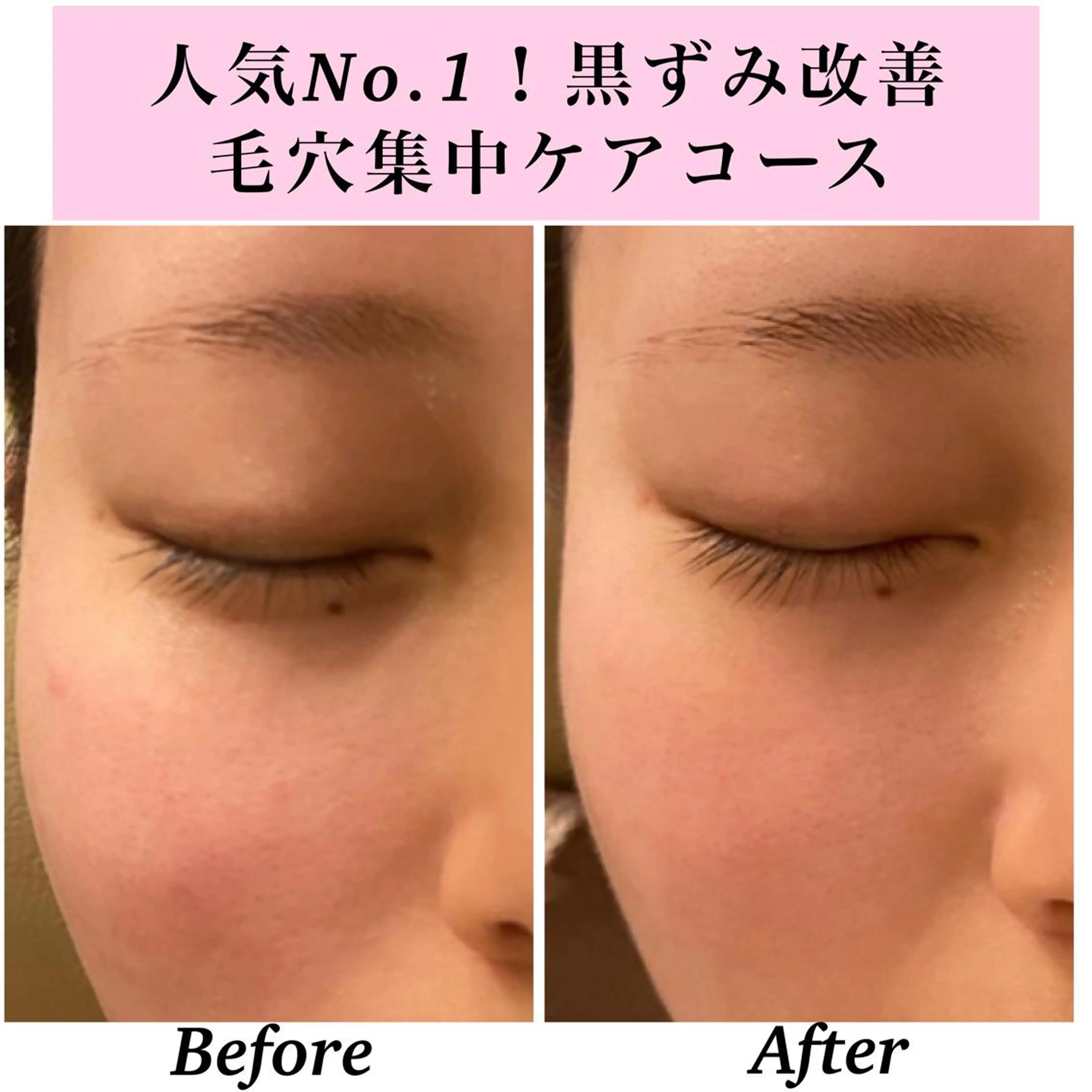 エステ リラク Bellesthe （ベルエステ）のエステ・リラクイメージ