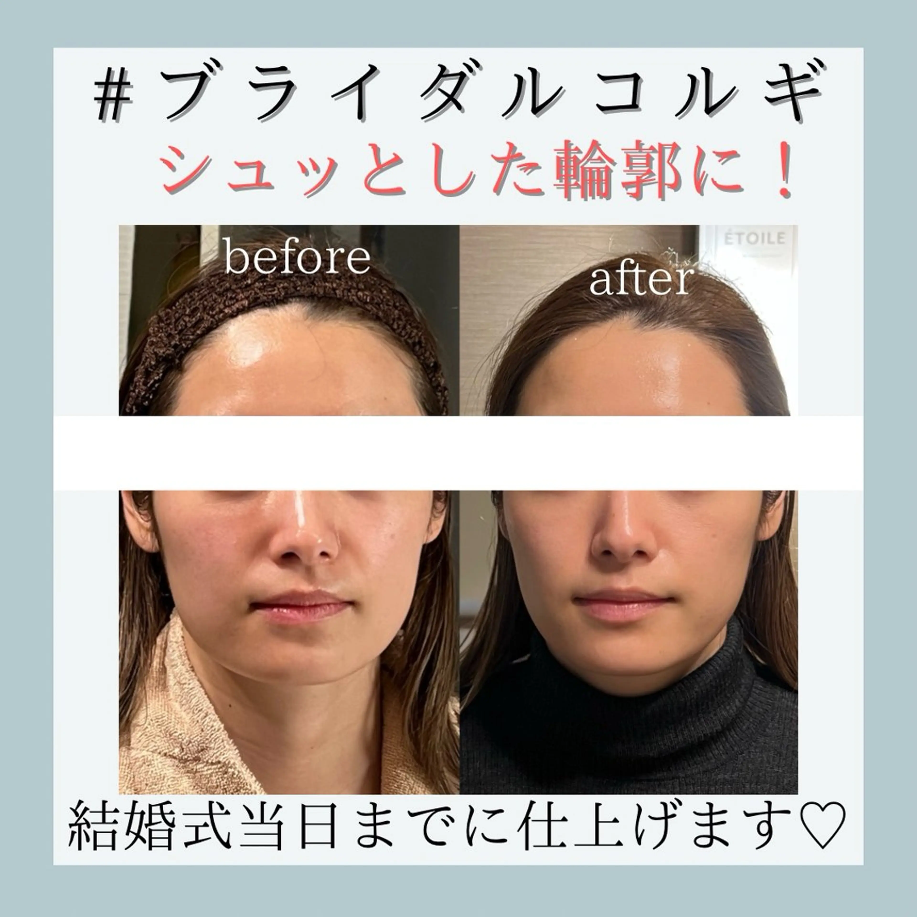 エステ リラク 小嶋萌 今池駅徒歩2分のエステ・リラクイメージ